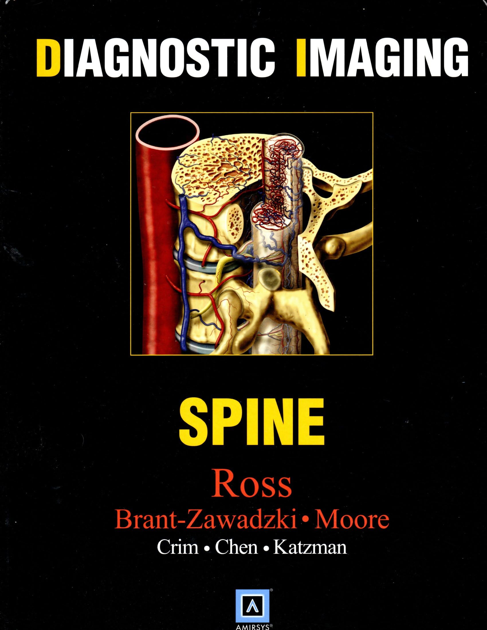 Diagnostic Imaging: Spine,Used