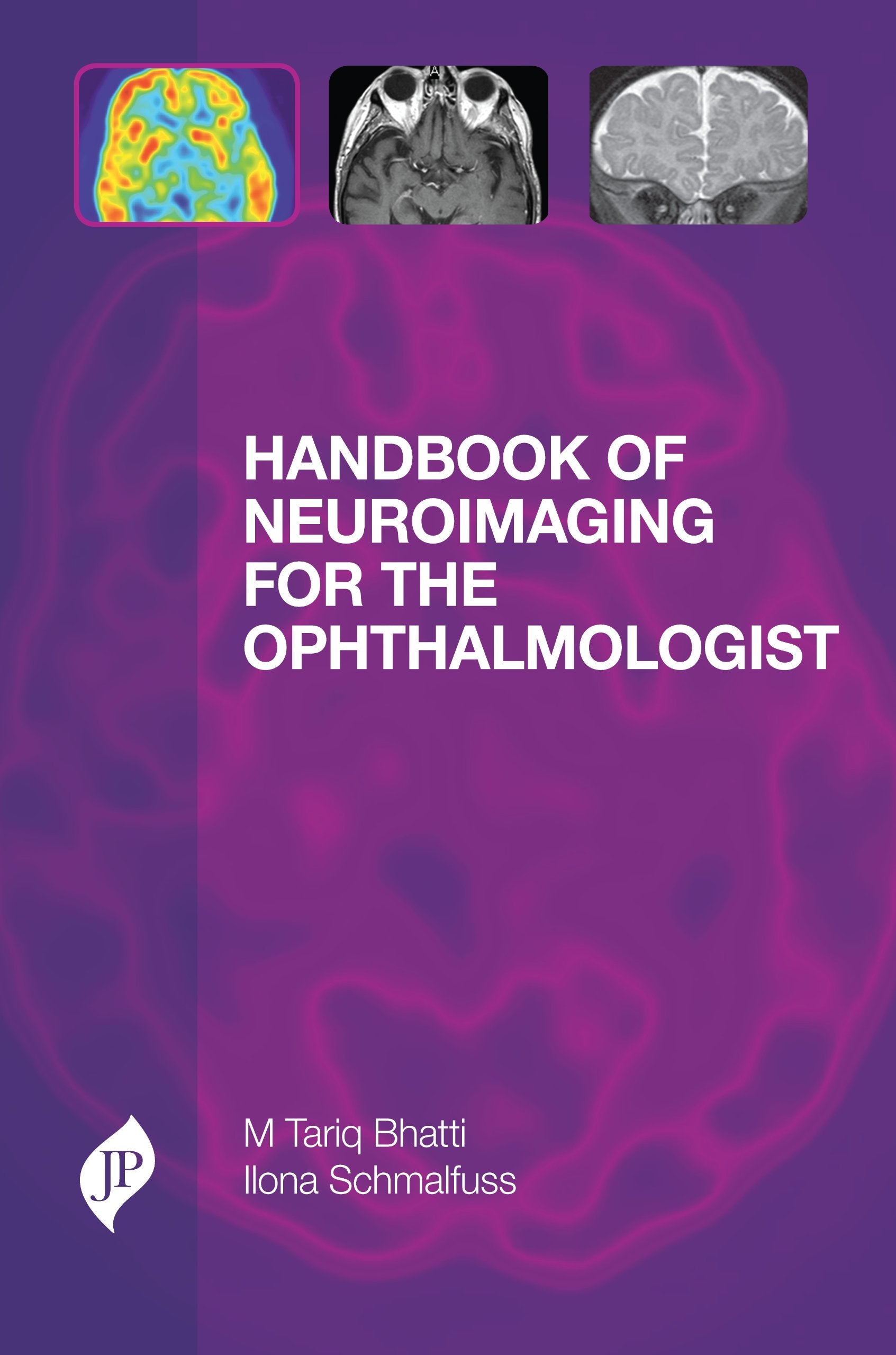 Handbook of Neuroimaging for the Ophthalmologist,Used