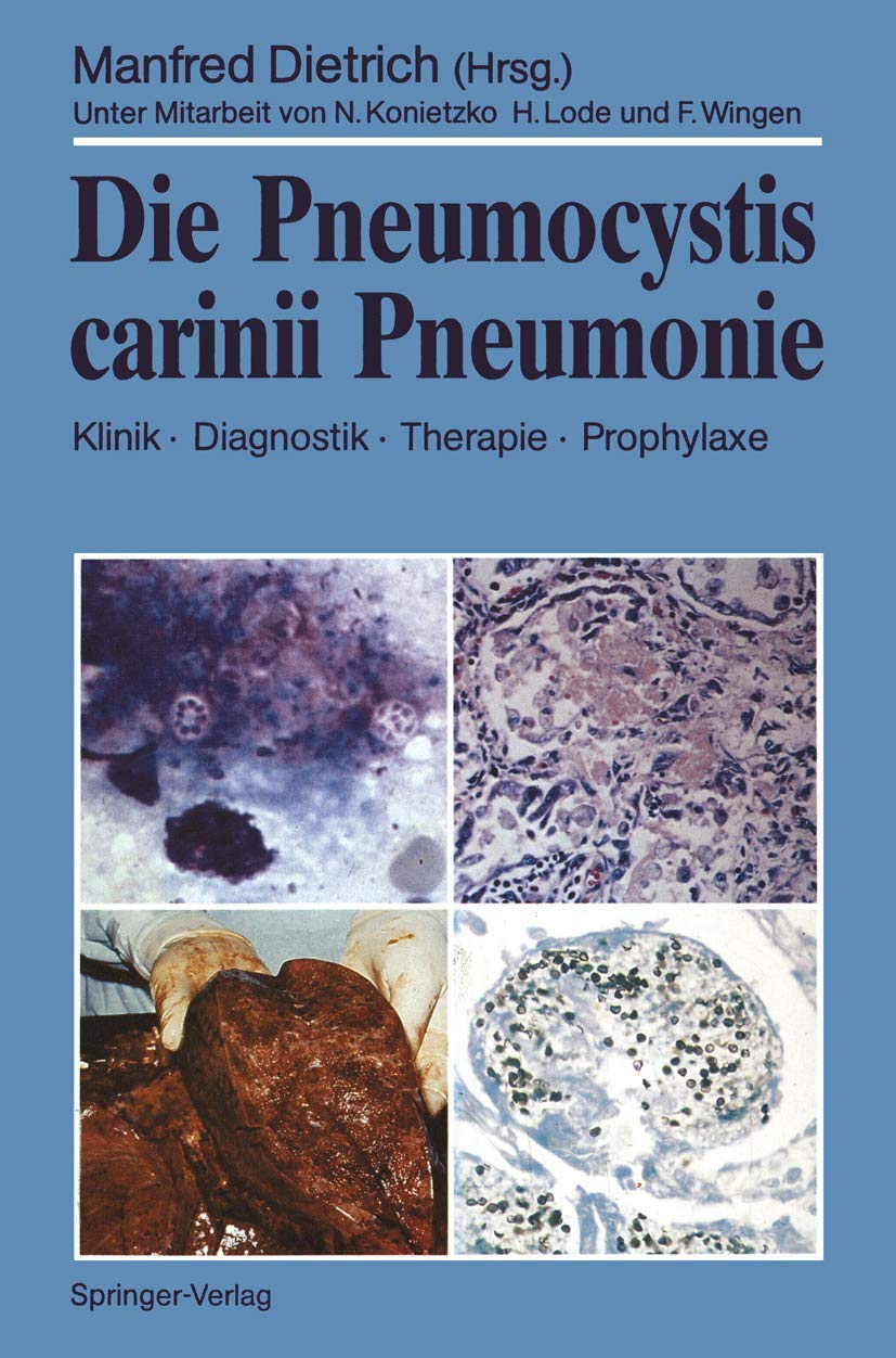 Die Pneumocystis carinii Pneumonie: Klinik  Diagnostik  Therapie  Prophylaxe (German Edition),Used