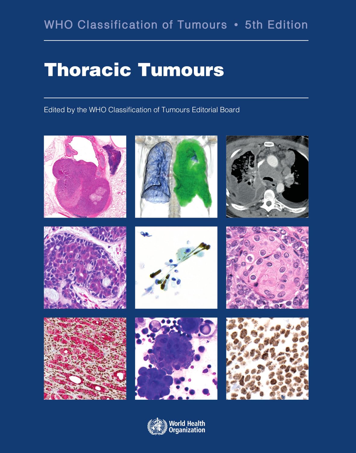 Thoracic Tumours: WHO Classification of Tumours,Used