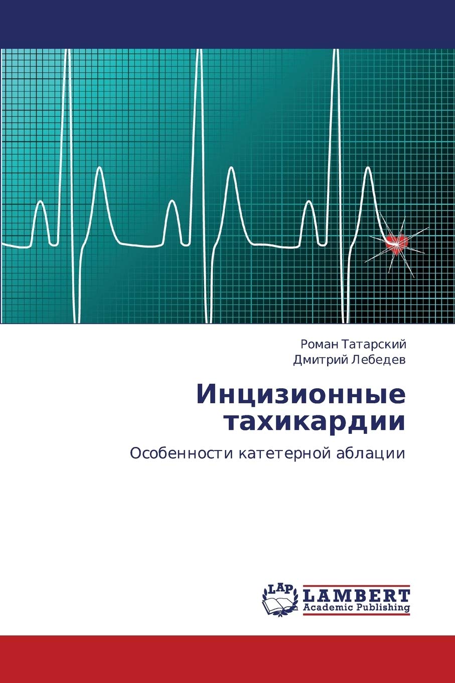 Intsizionnye takhikardii: Osobennosti kateternoy ablatsii (Russian Edition),Used