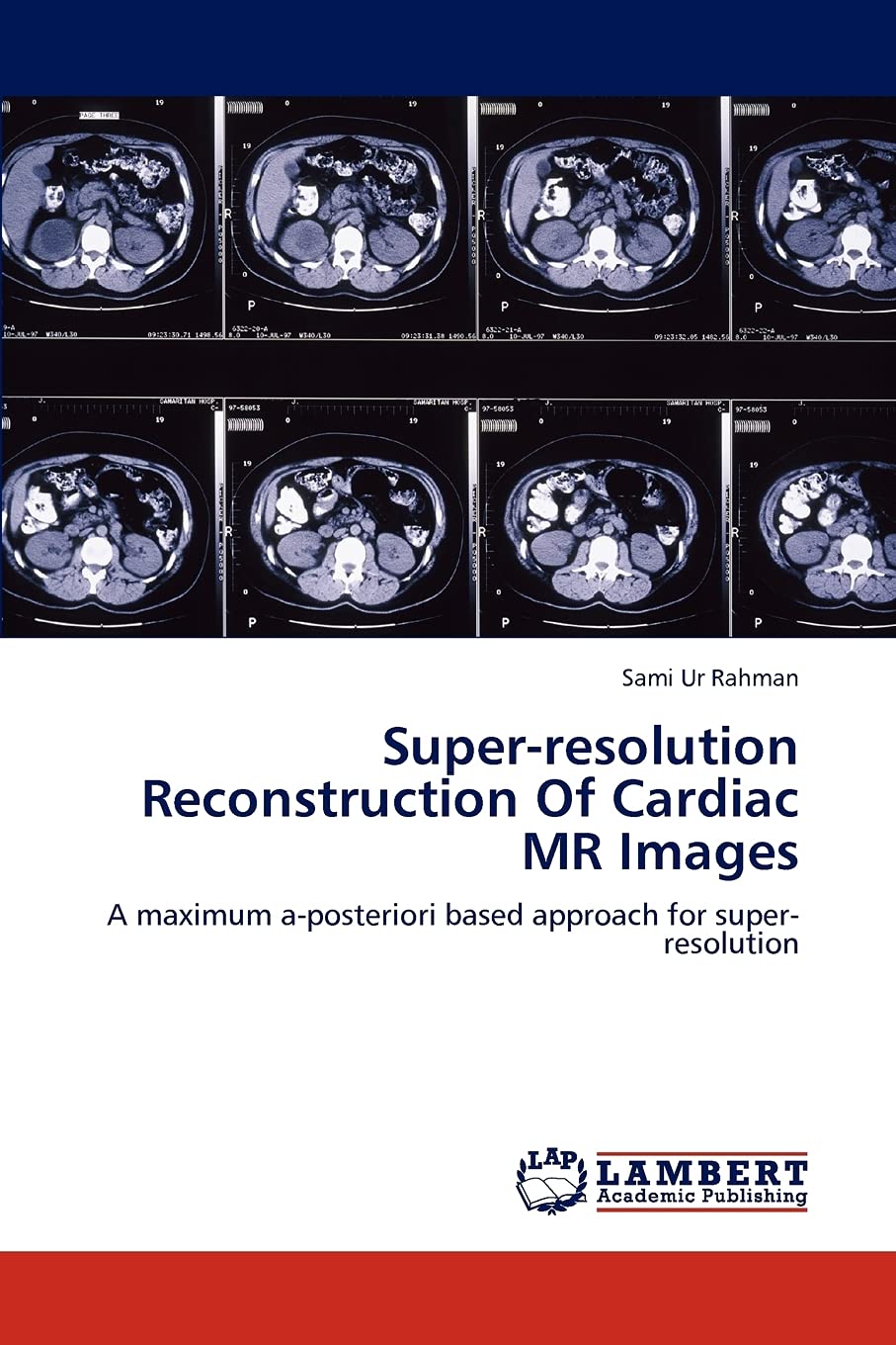 Superresolution Reconstruction Of Cardiac MR Images: A maximum aposteriori based approach for superresolution,Used