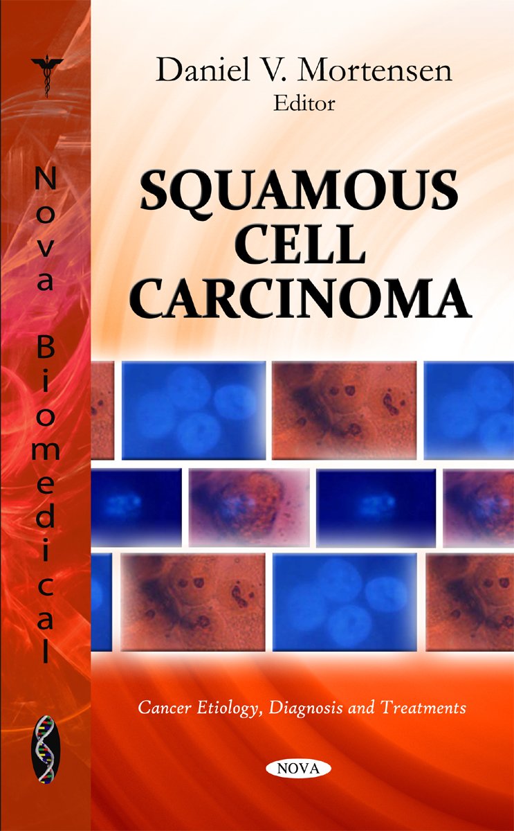 Squamous Cell Carcinoma (Cancer Etiology, Diagnosis And Treatments),Used