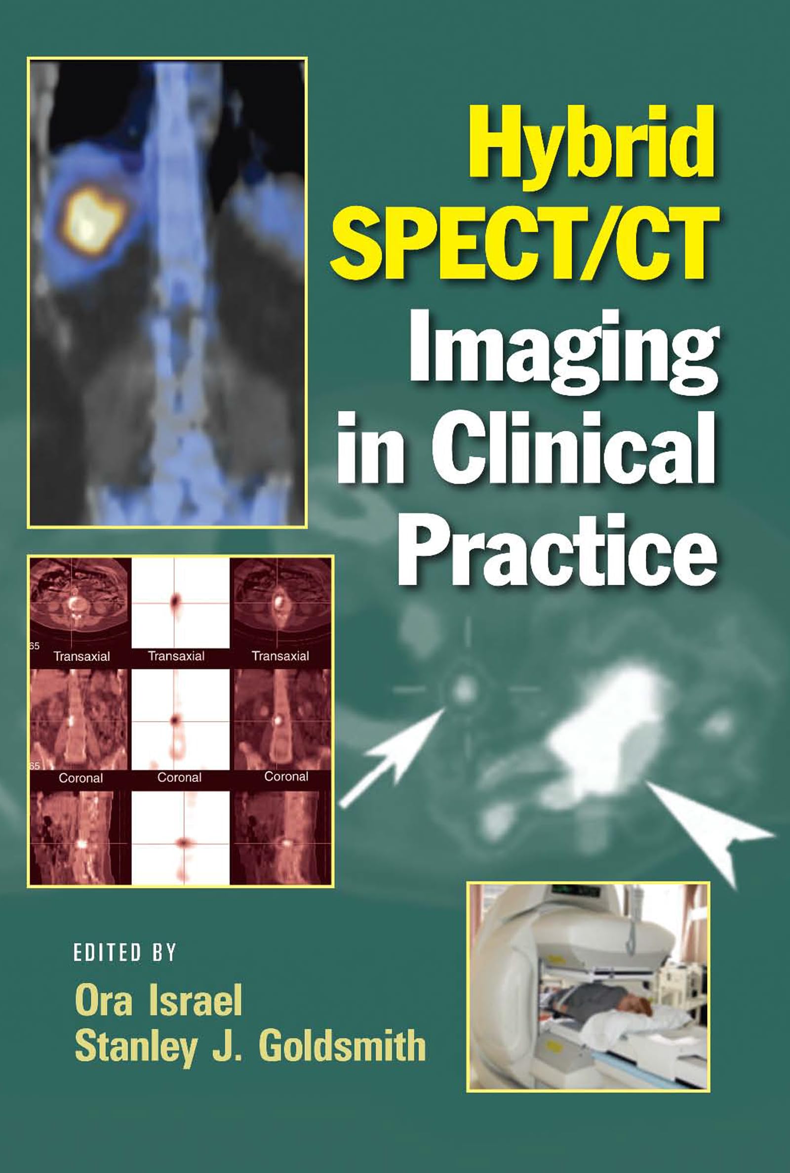 Hybrid Spect/Ct Imaging In Clinical Practice,Used