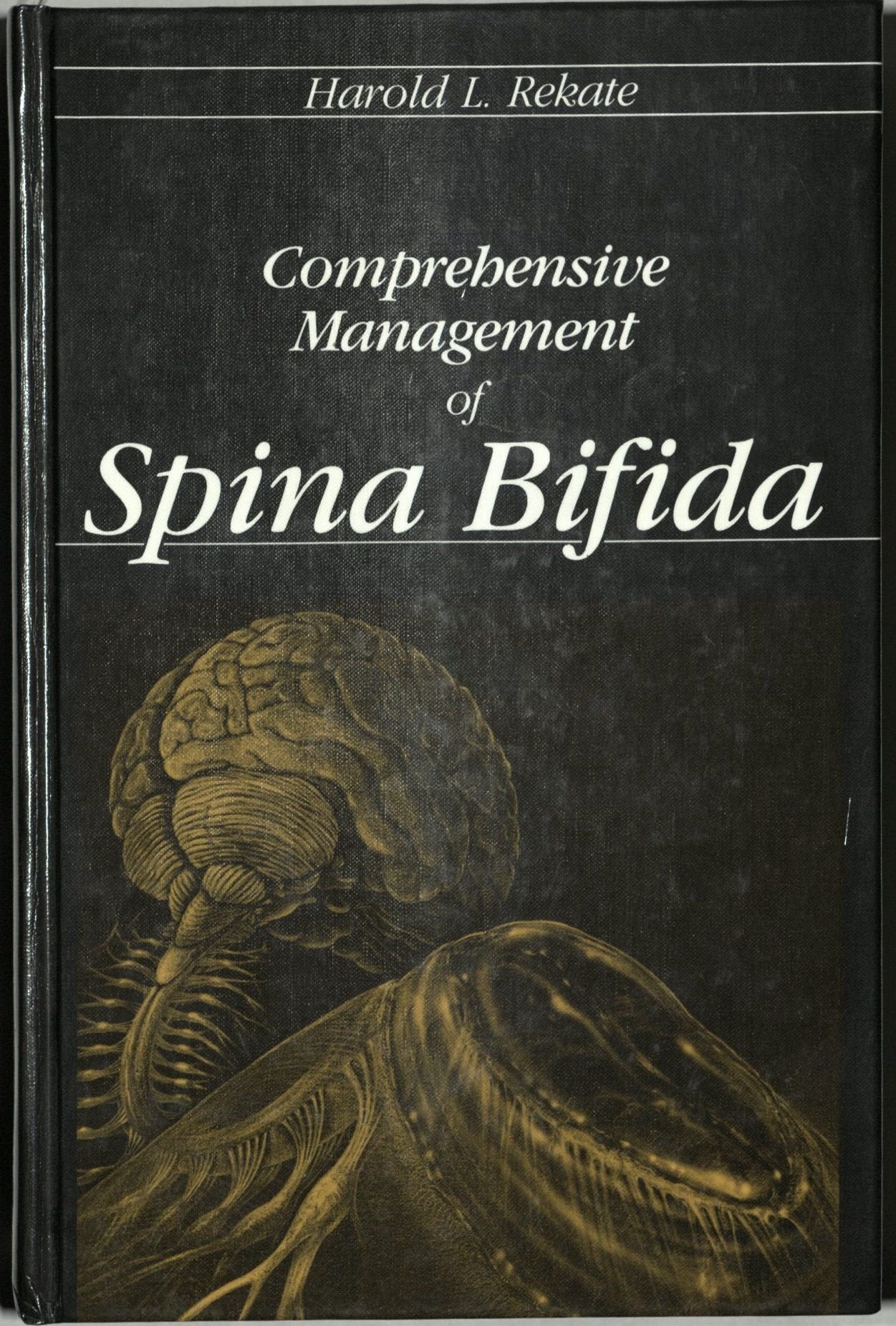 Comprehensive Management of Spina Bifida,Used