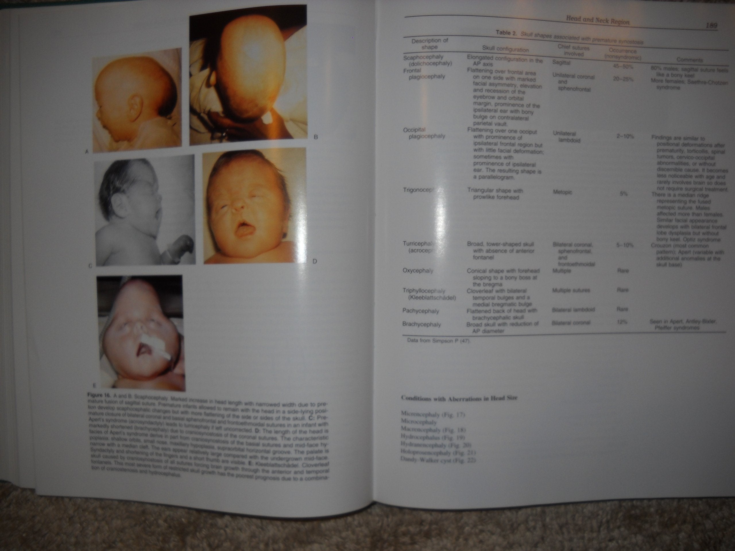 Physical Diagnosis In Neonatology,New
