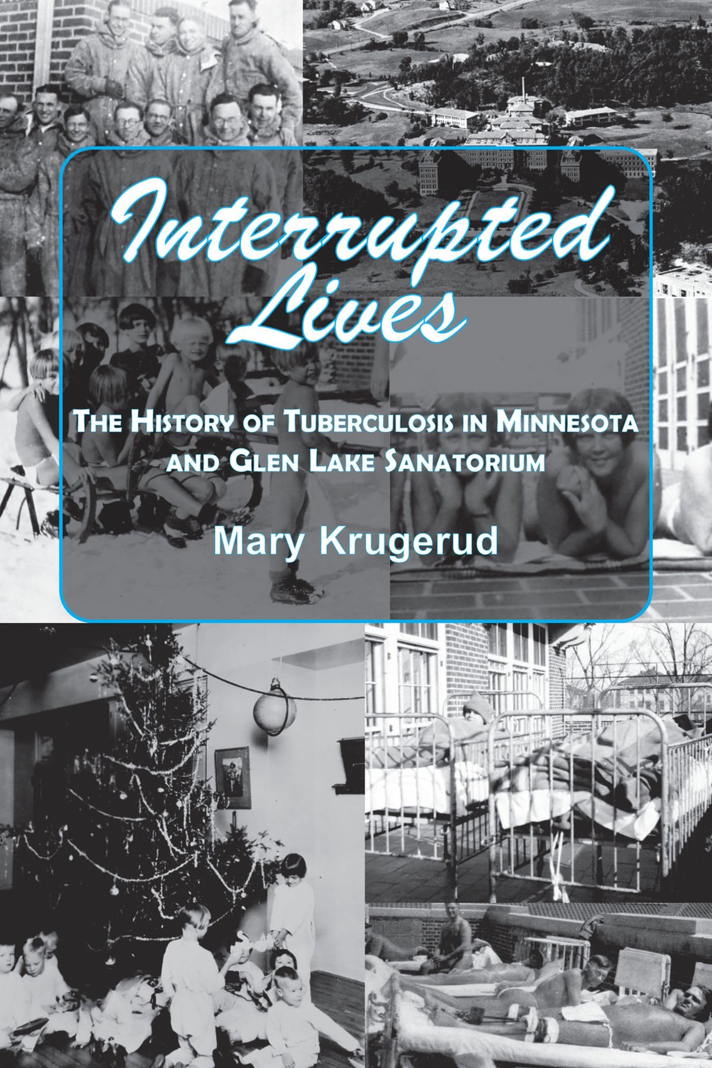 Interrupted Lives: The History of Tuberculosis in Minnesota and Glen Lake Sanitorium,Used
