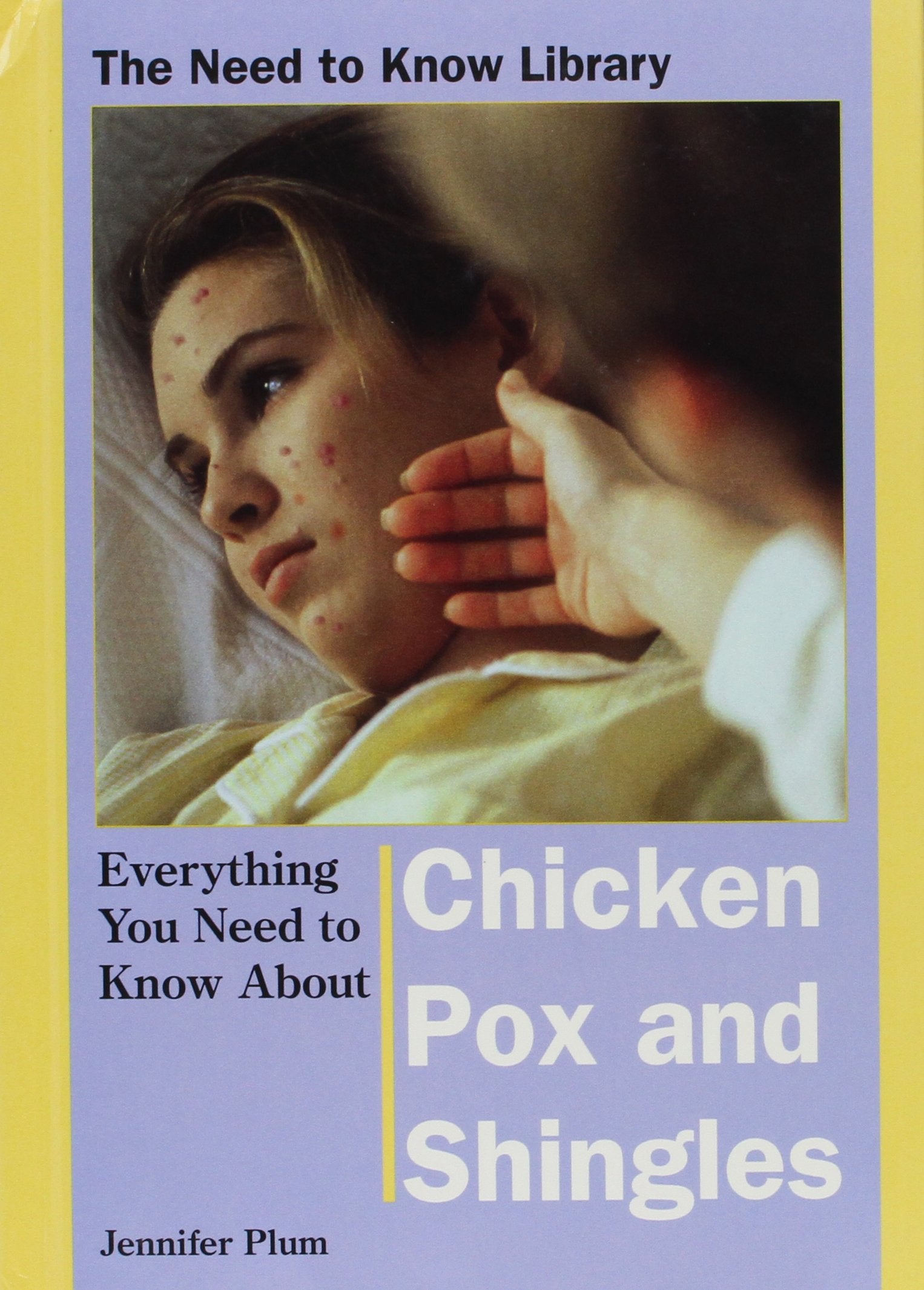 Everything You Need To Know About Chicken Pox And Shingles (Need To Know Library),Used