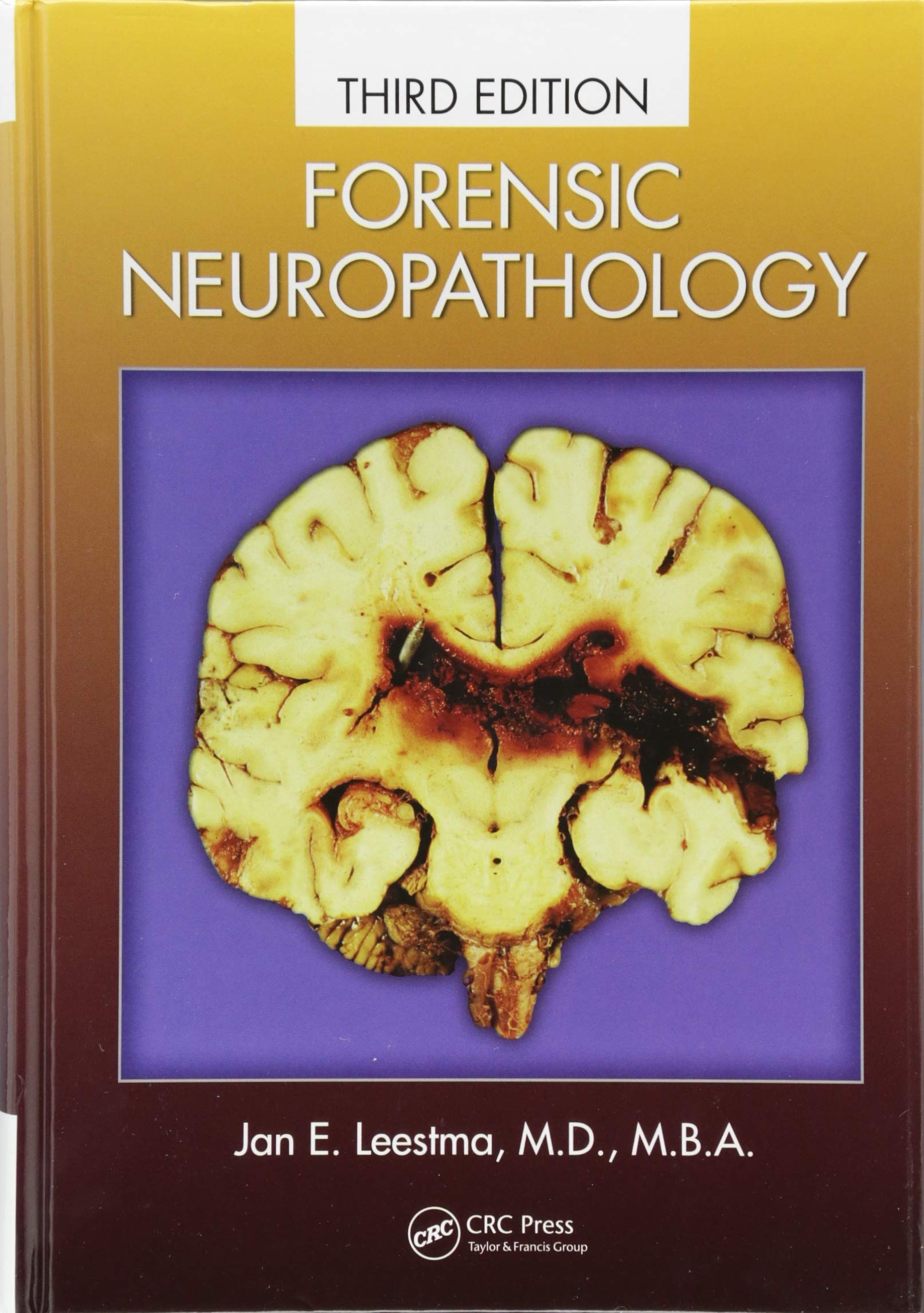 Forensic Neuropathology,Used