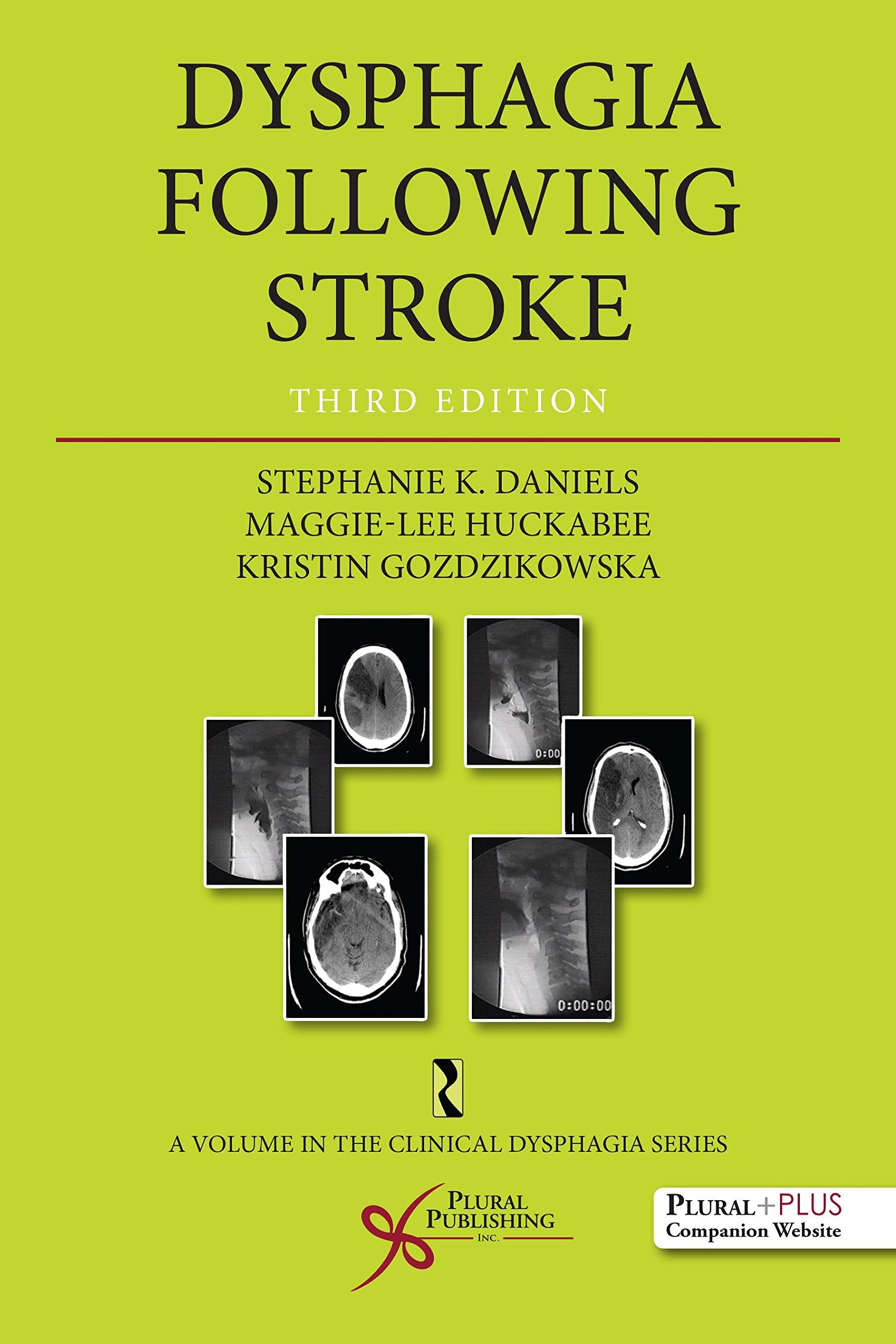 Dysphagia Following Stroke (Clinical Dysphagia),Used