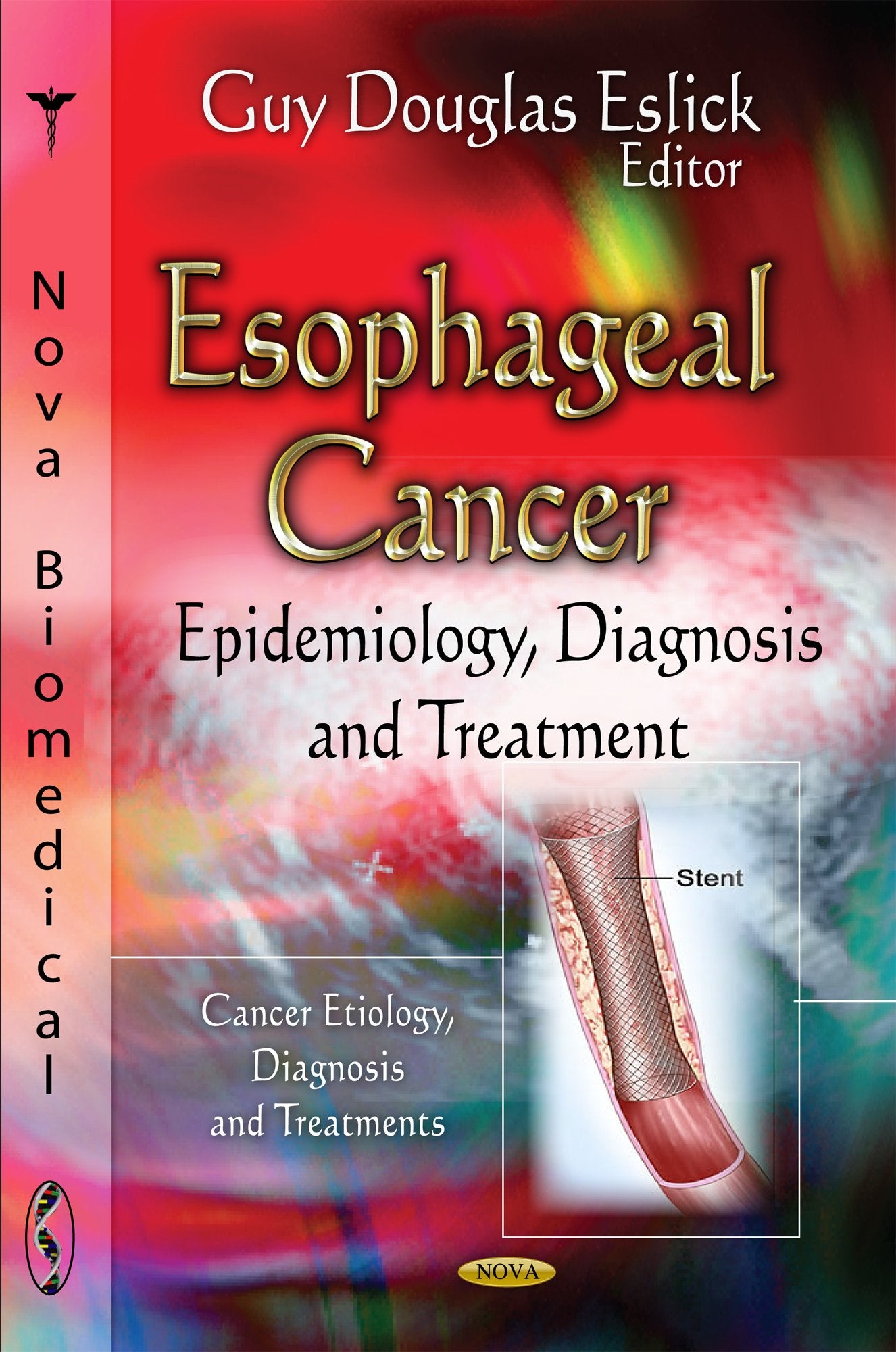 Esophageal Cancer: Epidemiology, Diagnosis And Treatment (Cancer Etiology, Diagnosis And Treatments),Used