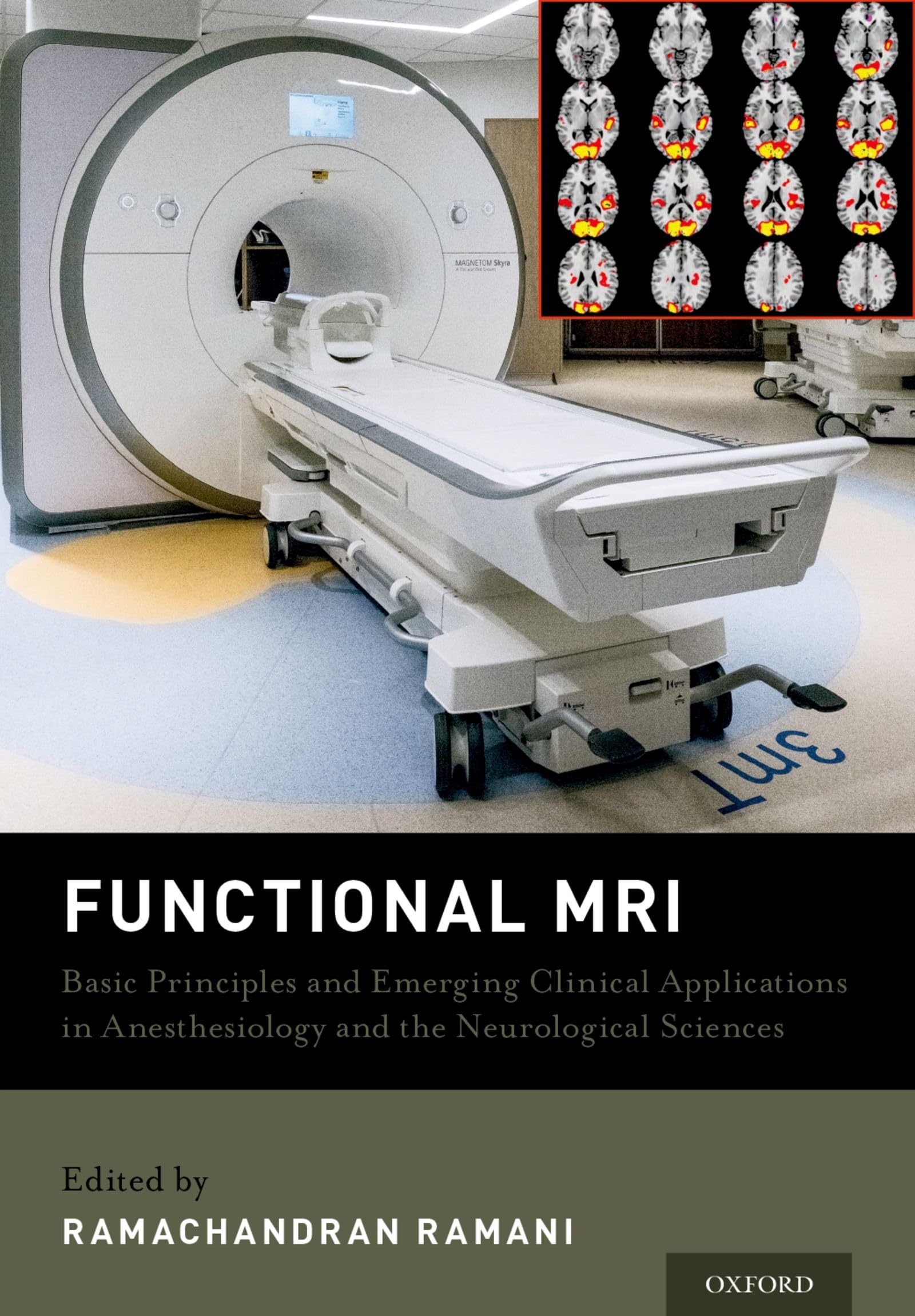 Functional MRI: Basic Principles and Emerging Clinical Applications for Anesthesiology and the Neurological Sciences,Used