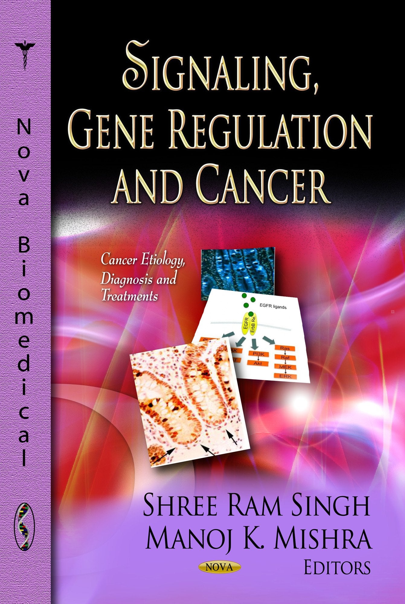 Signaling, Gene Regulation and Cancer (Cancer Etiology, Diagnosis and Treatments),Used