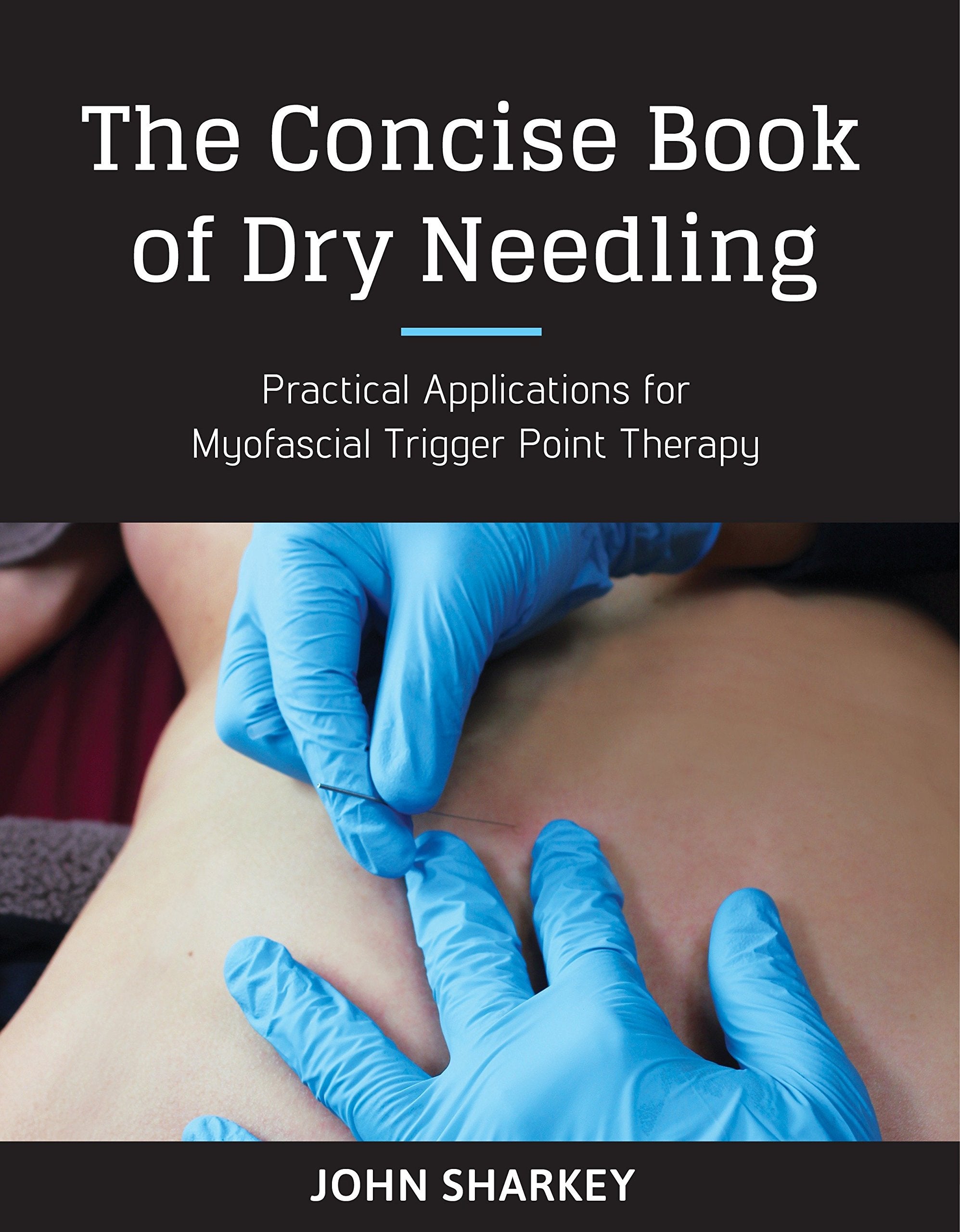 The Concise Book of Dry Needling: A Practitioner's Guide to Myofascial Trigger Point Applications,New