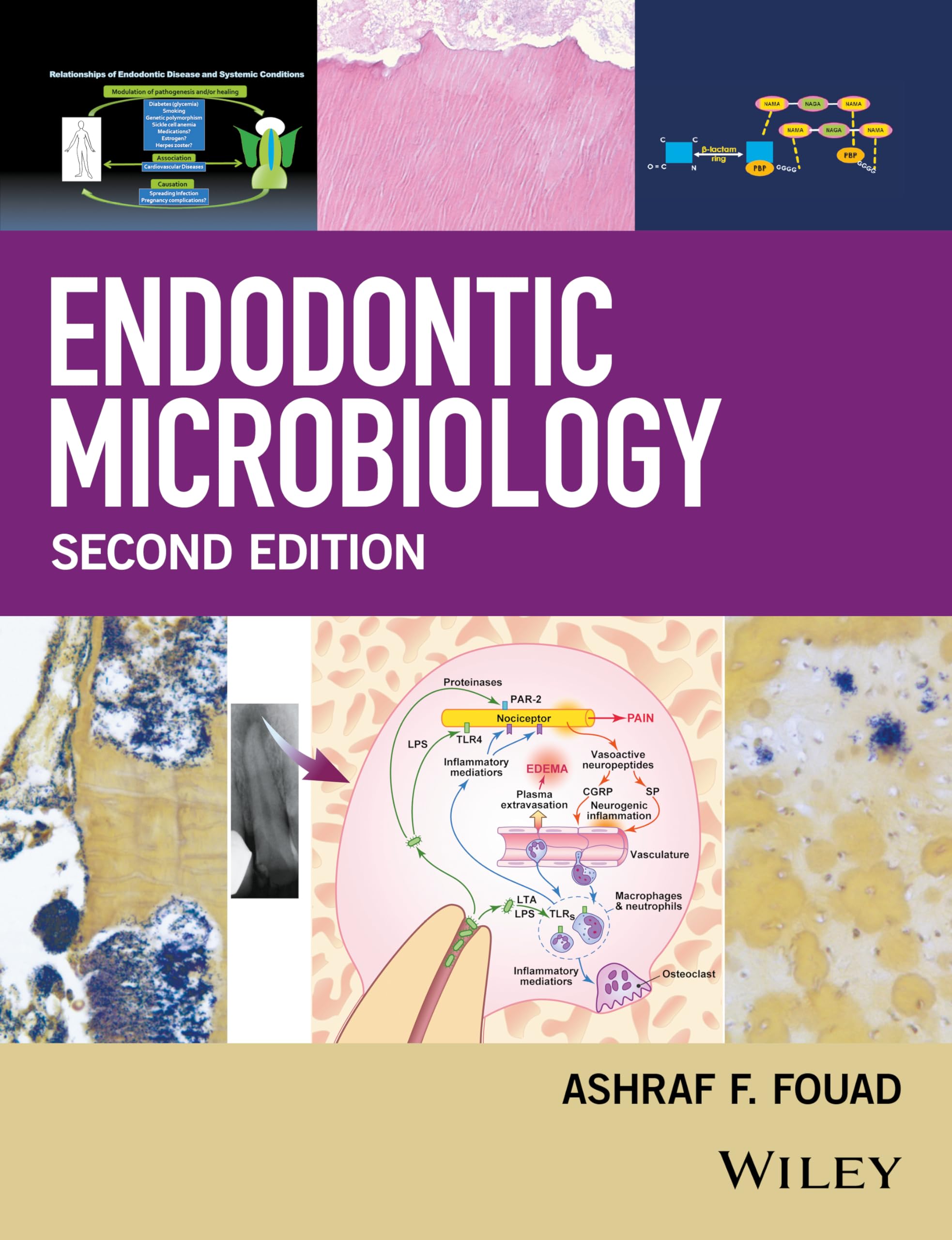 Endodontic Microbiology,Used