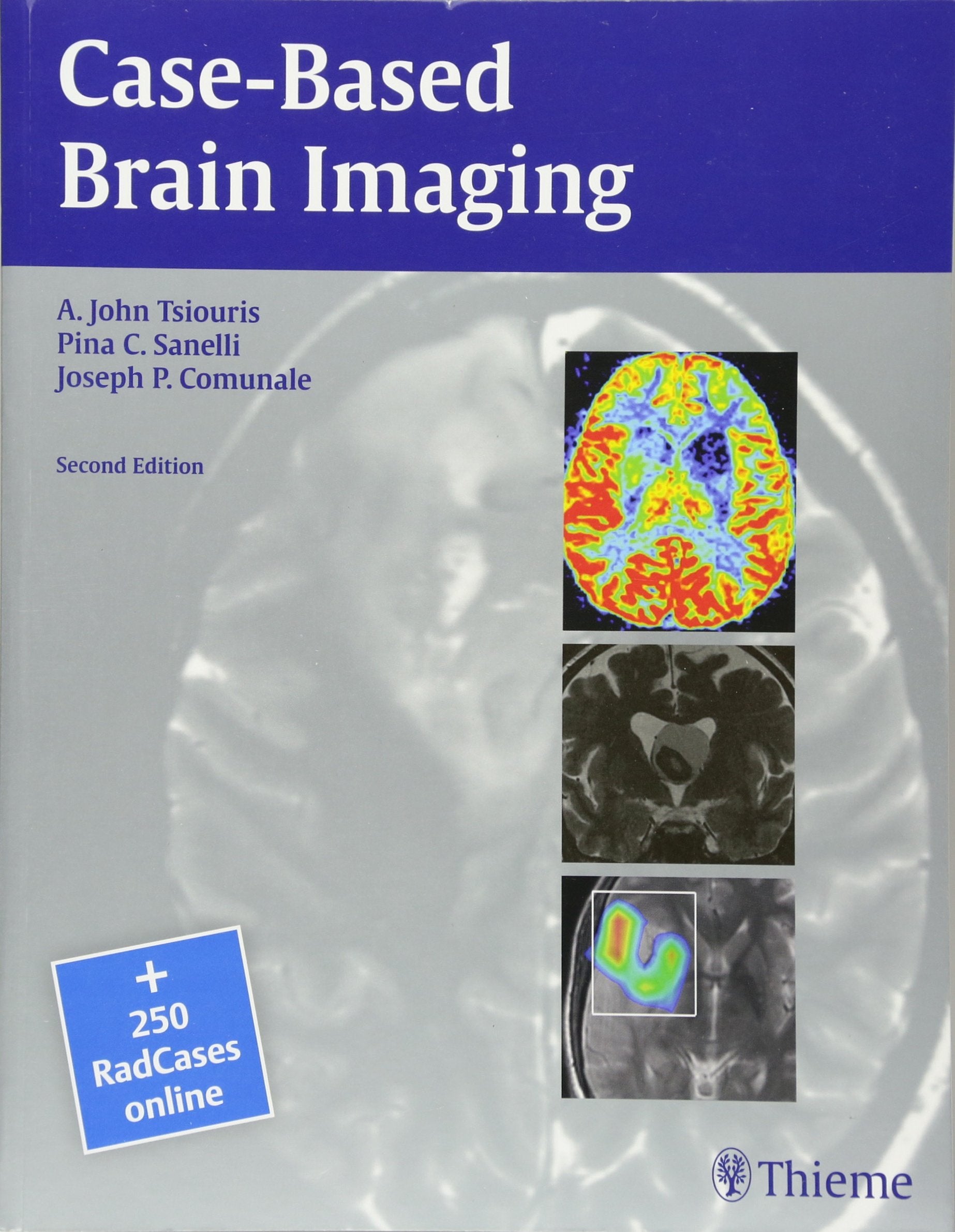 Casebased Brain Imaging,Used