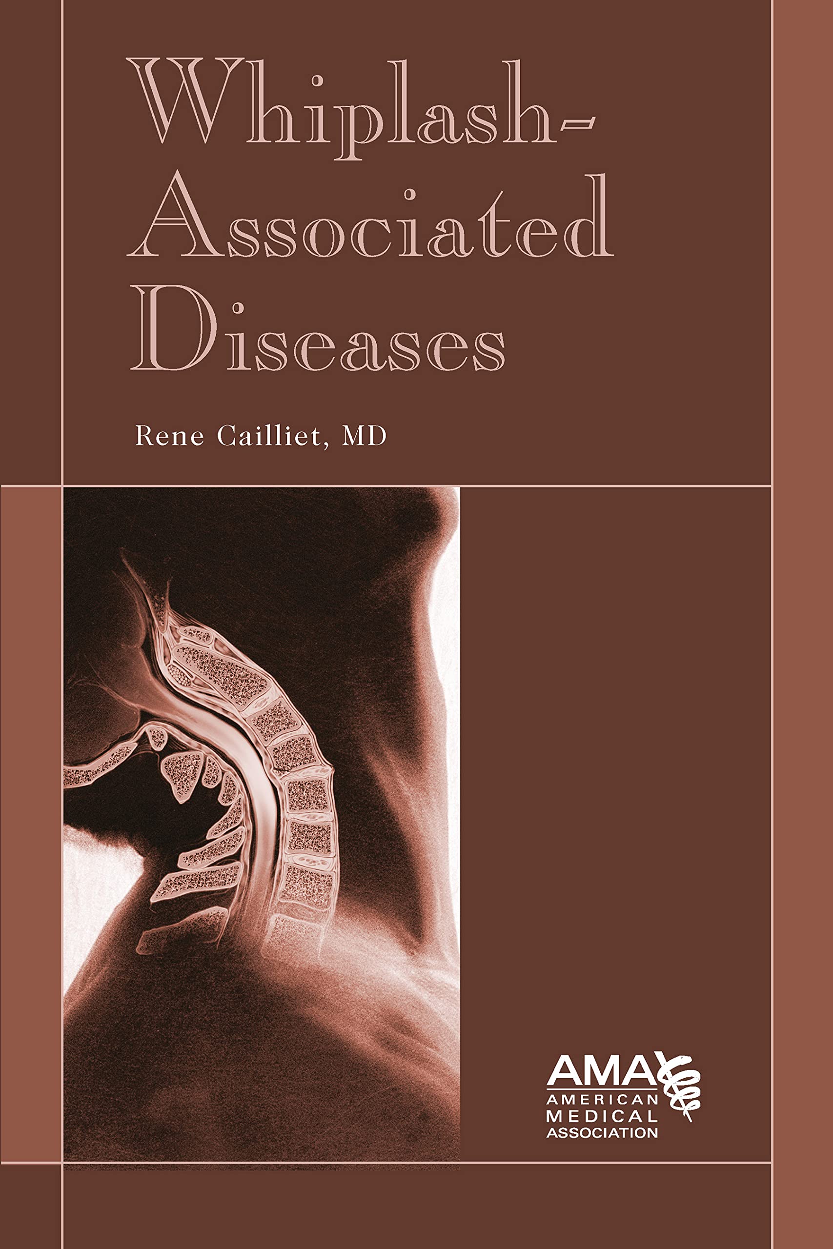 WhiplashAssociated Diseases,Used