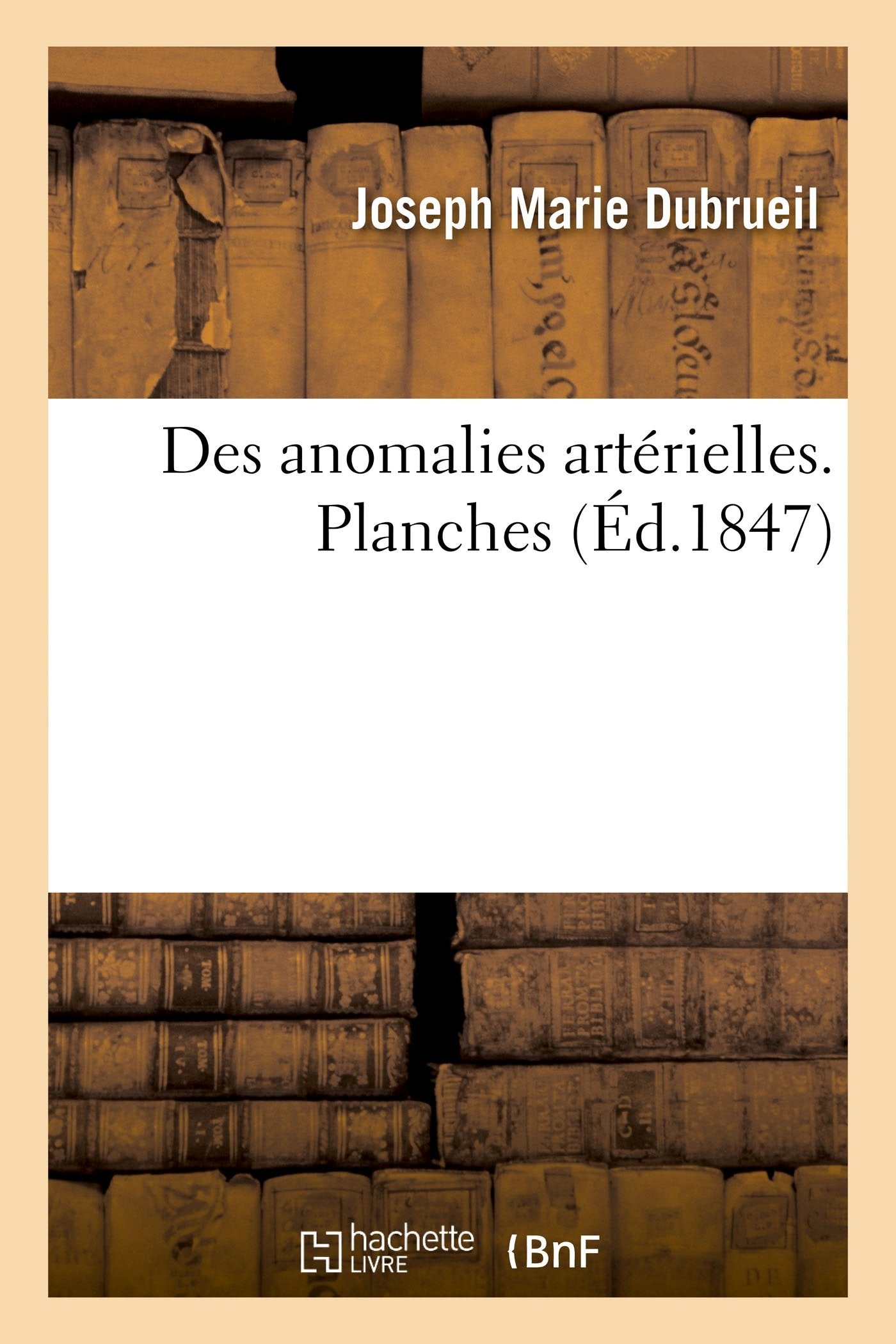 Des anomalies artrielles considres dans leurs rapports avec la pathologie: et les oprations chirurgicales. Planches (Sci,Used