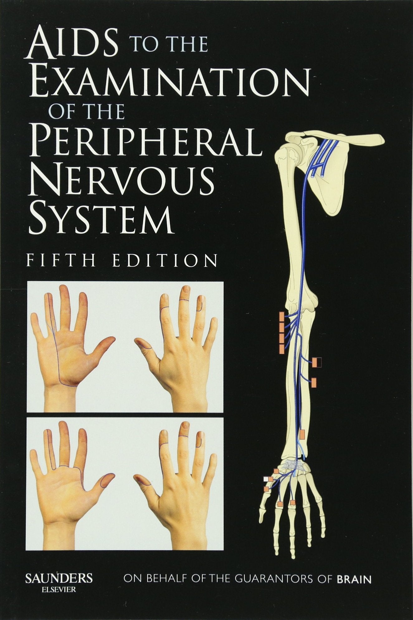 Aids to the Examination of the Peripheral Nervous System,Used