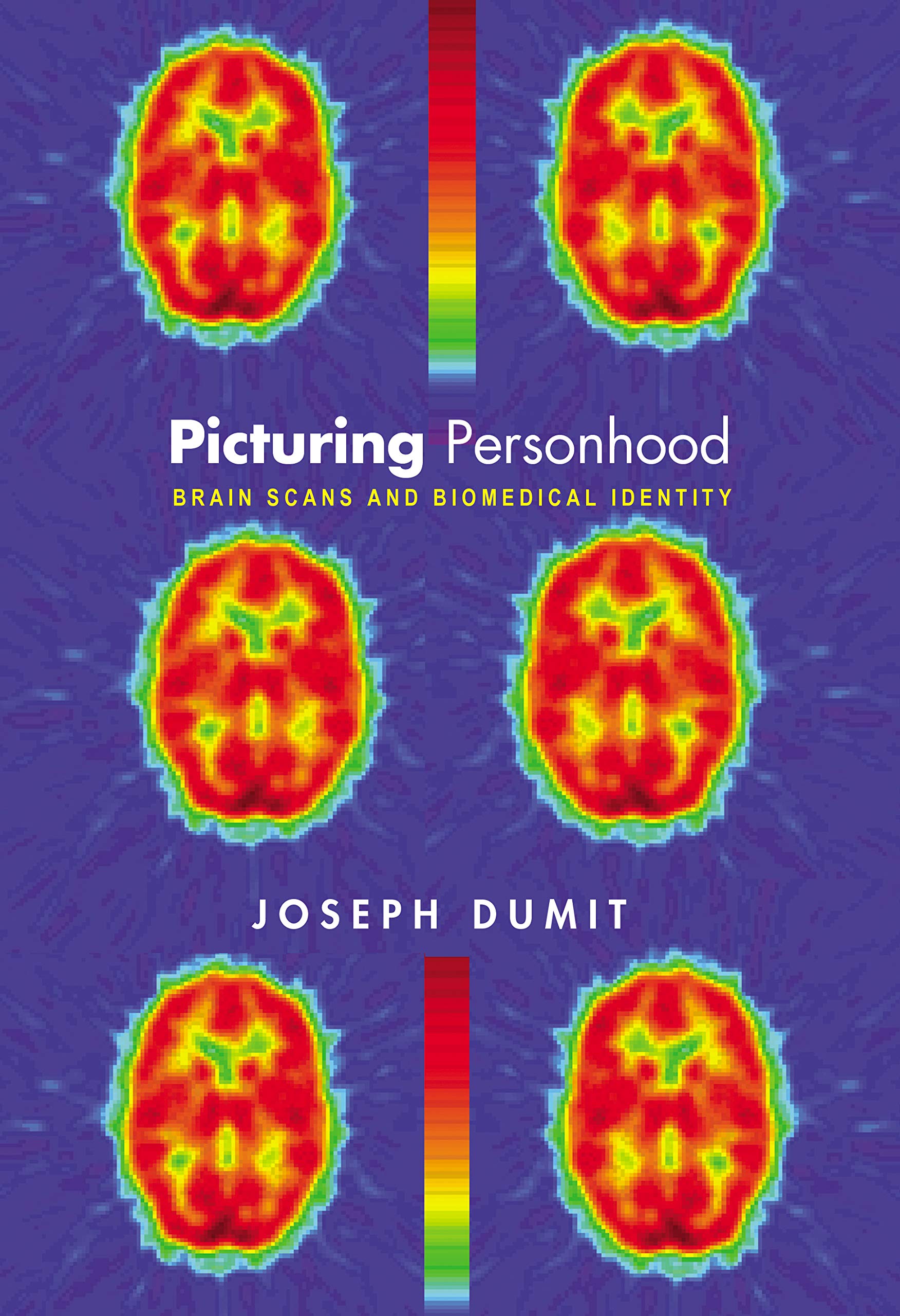 Picturing Personhood: Brain Scans and Biomedical Identity (InFormation),New