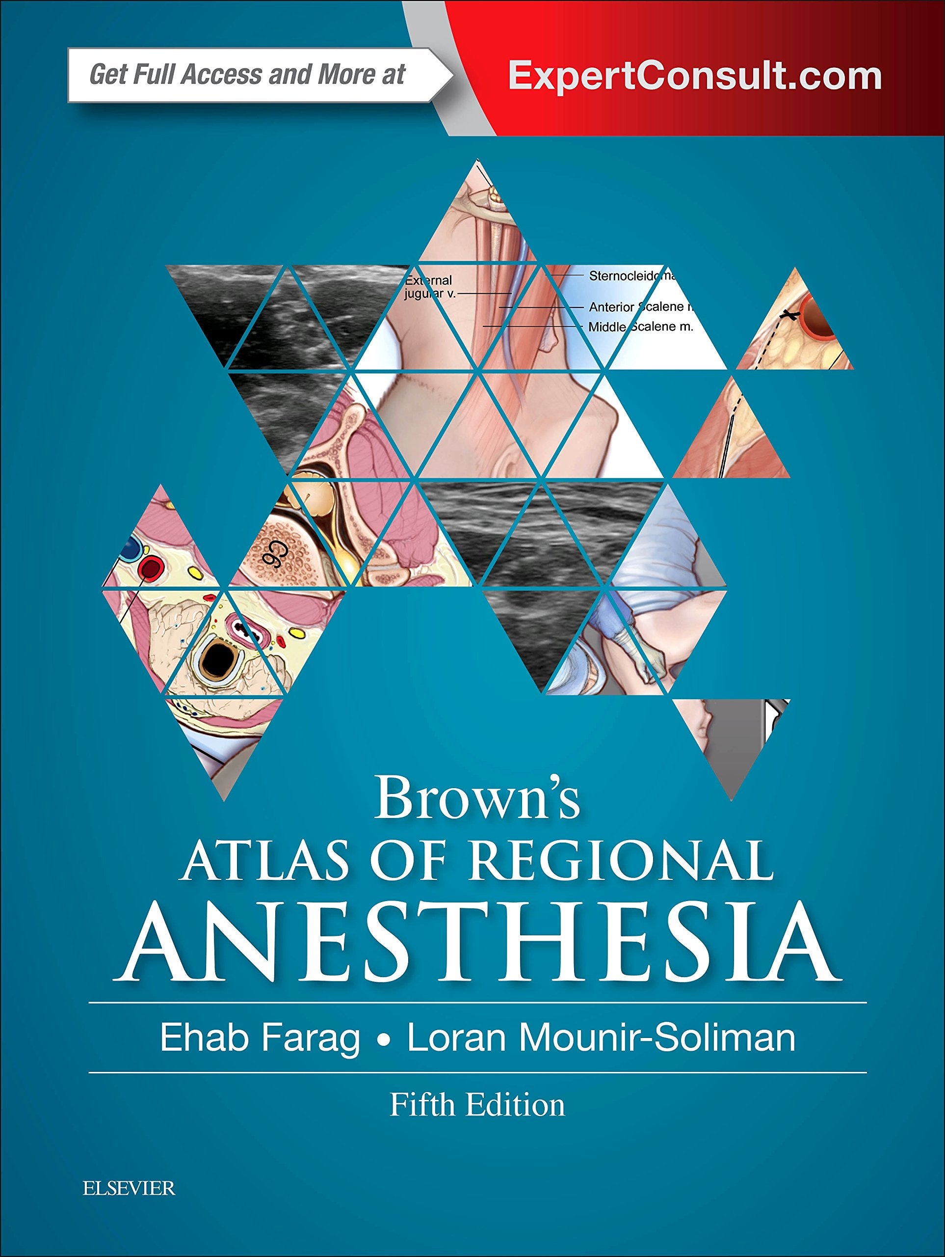 Brown's Atlas of Regional Anesthesia,Used