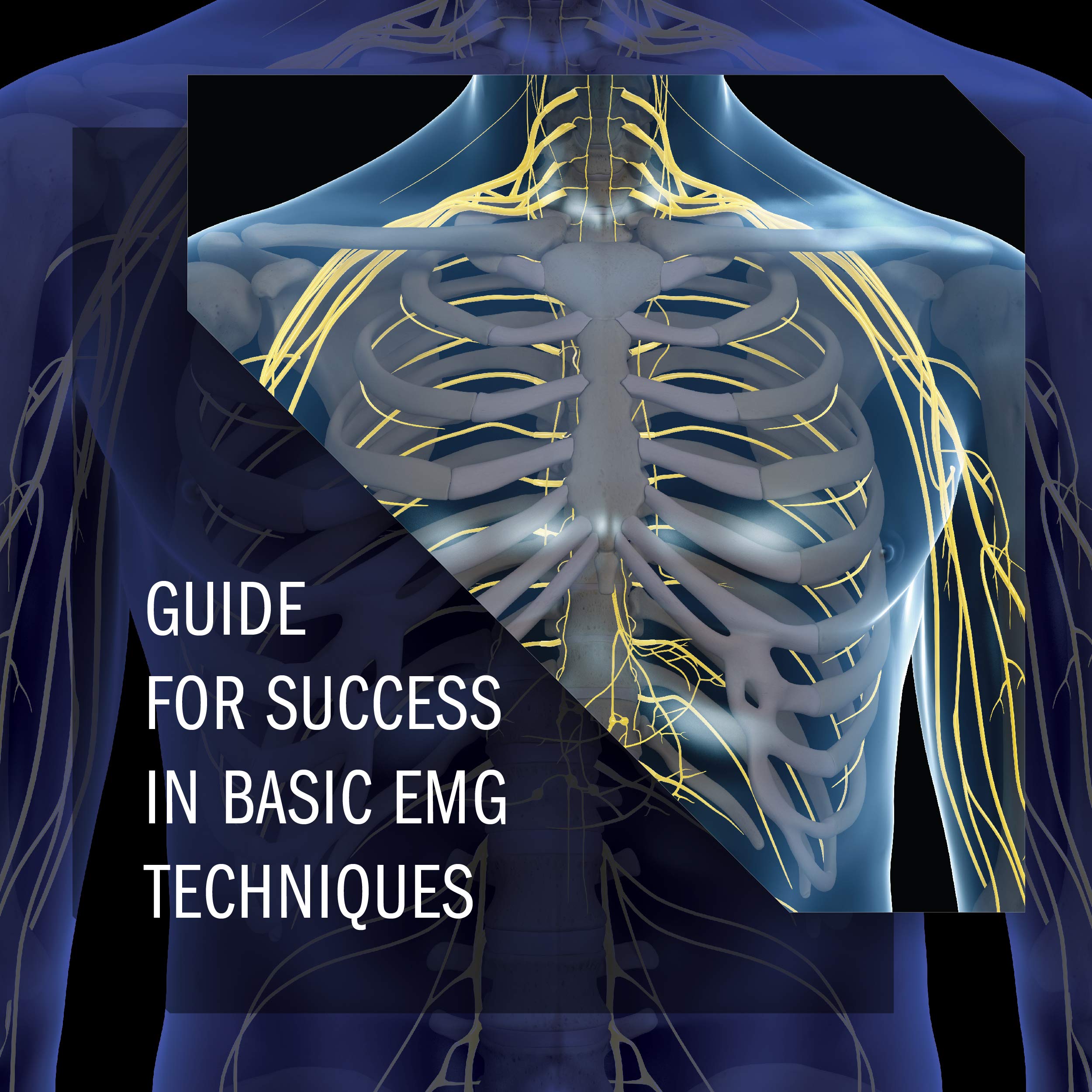 McLean EMG Guide, Second Edition A Comprehensive Guide to Mastering Basic Electrodiagnostic Techniques,Used