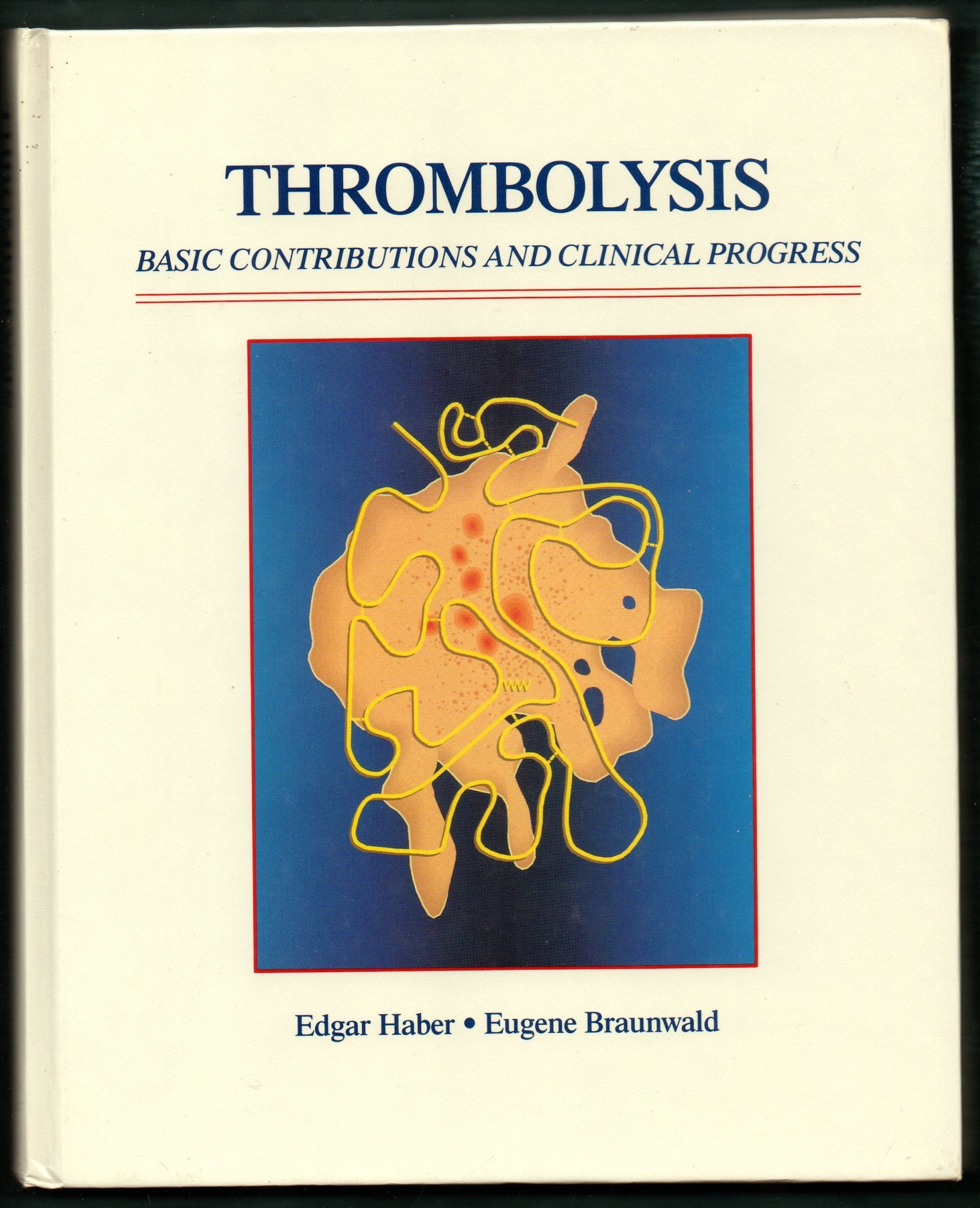 Thrombolysis: Basic Contributions and Clinical Progress,Used