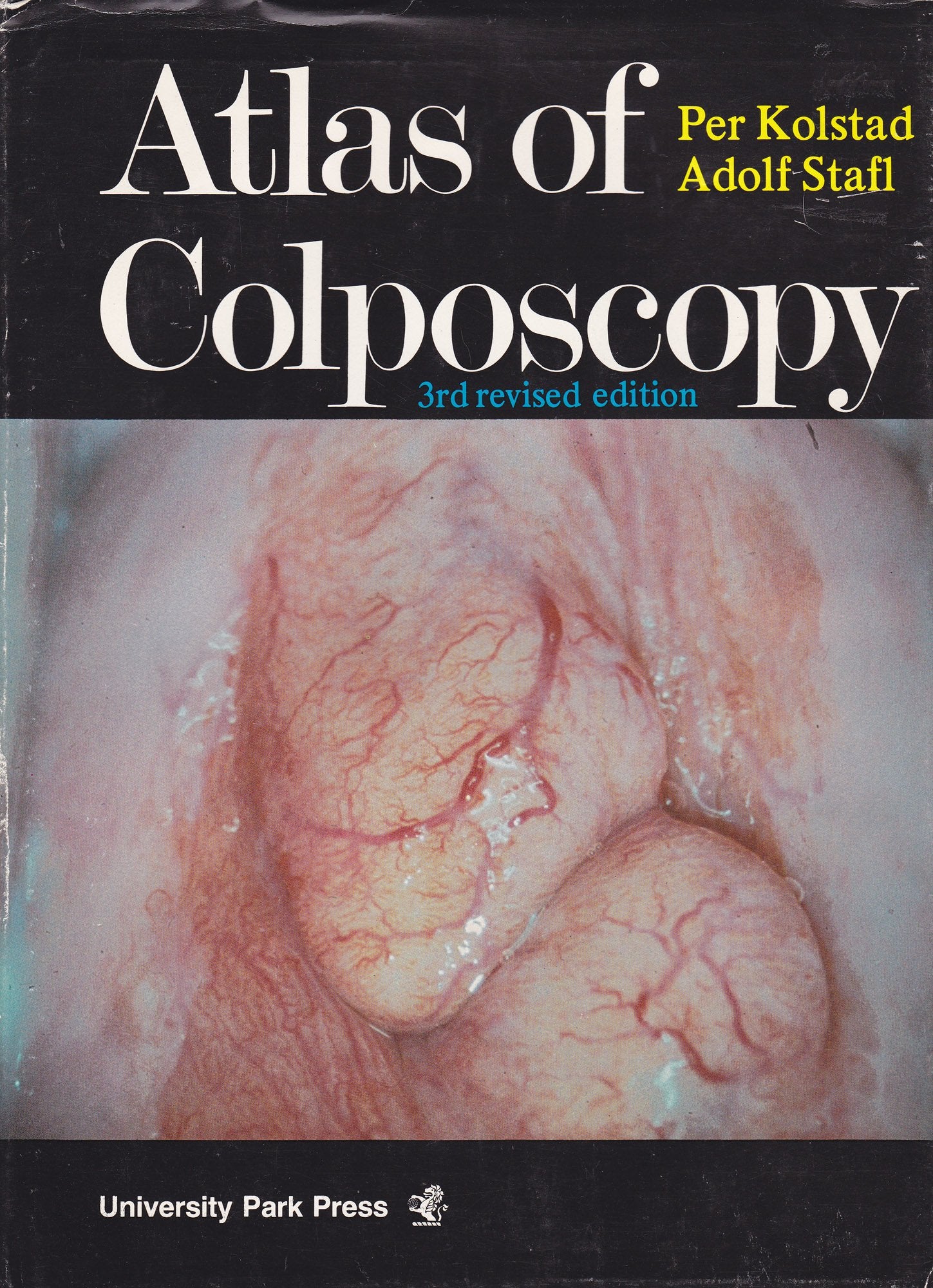 Atlas of Colposcopy,Used