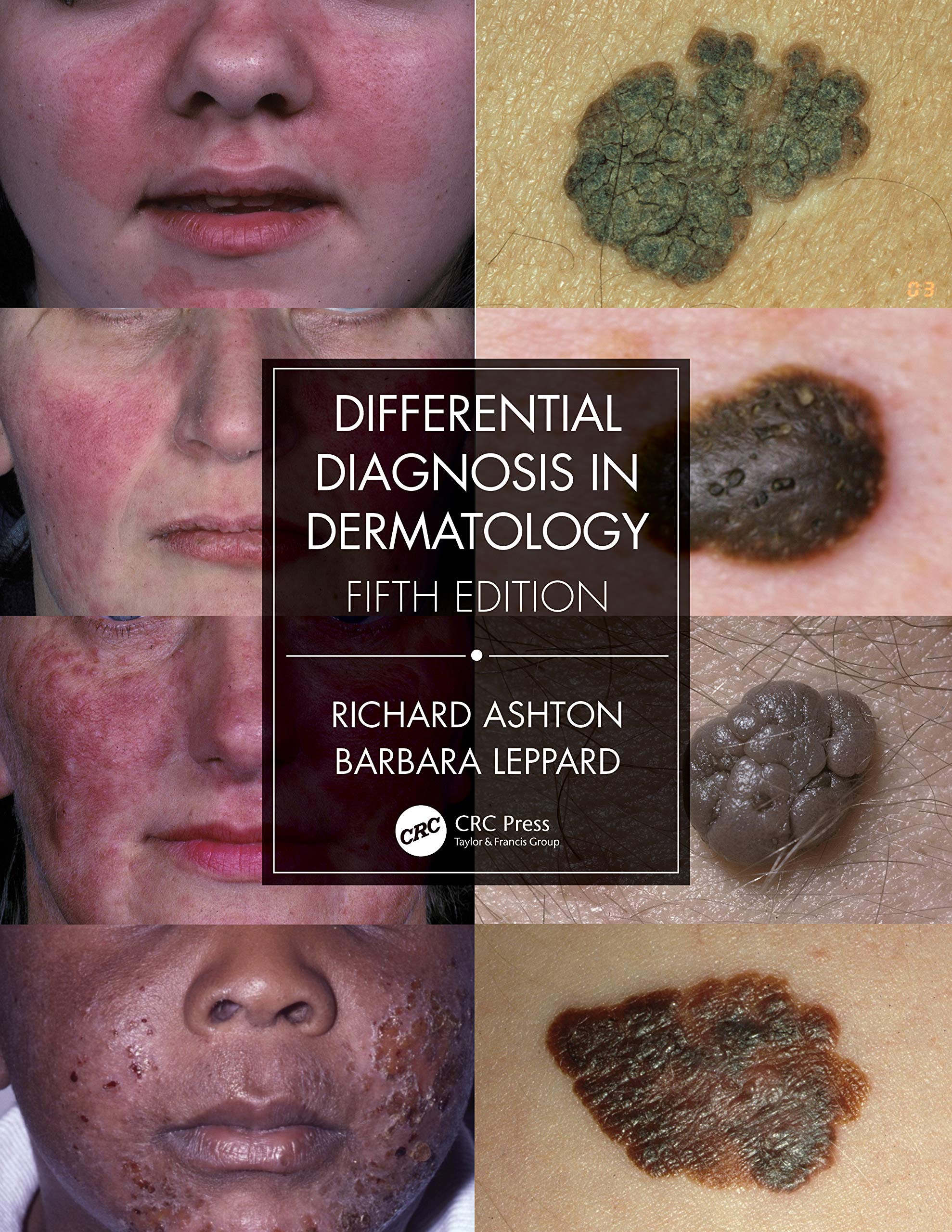 Differential Diagnosis in Dermatology,Used