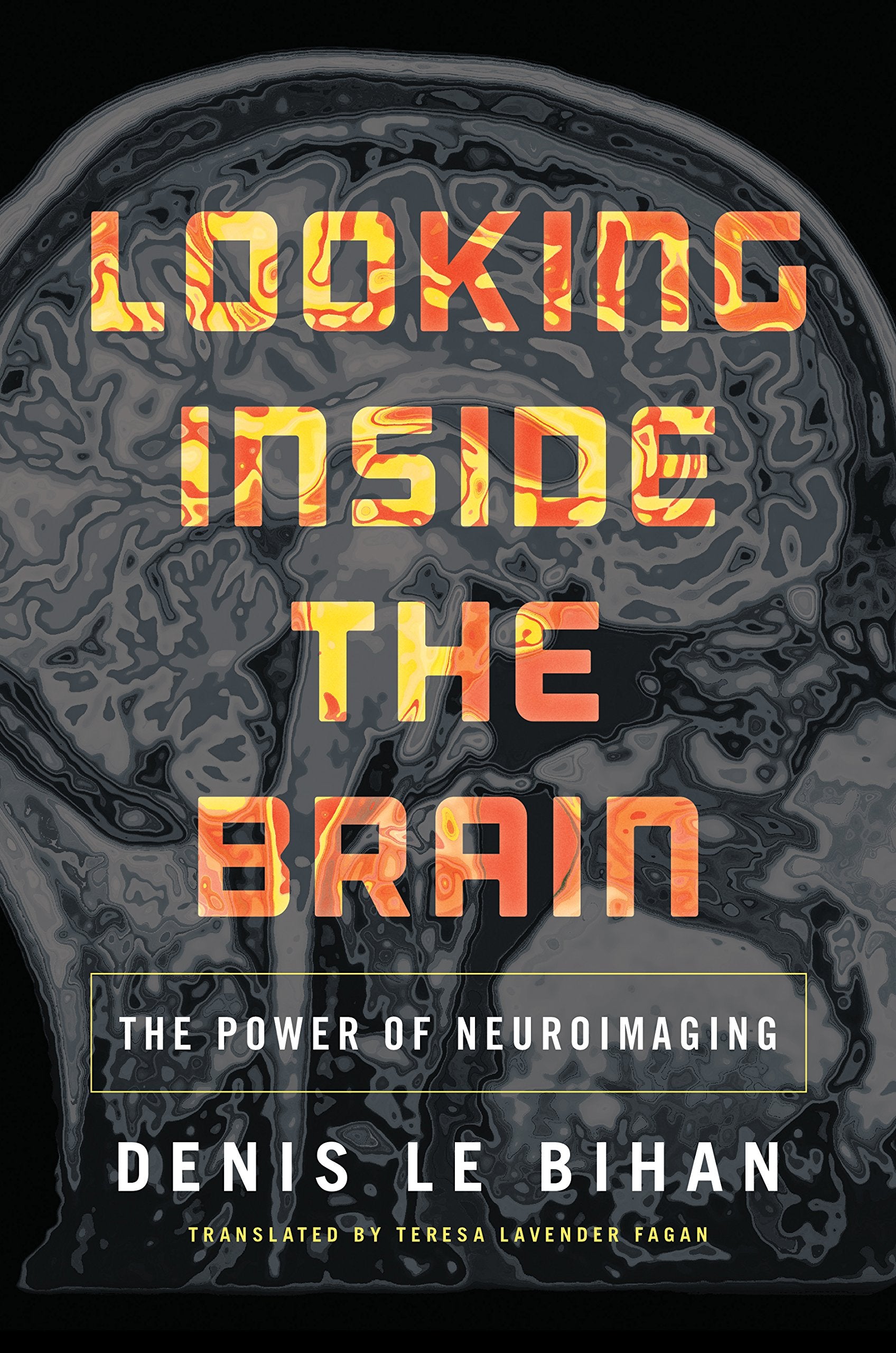 Looking Inside The Brain: The Power Of Neuroimaging