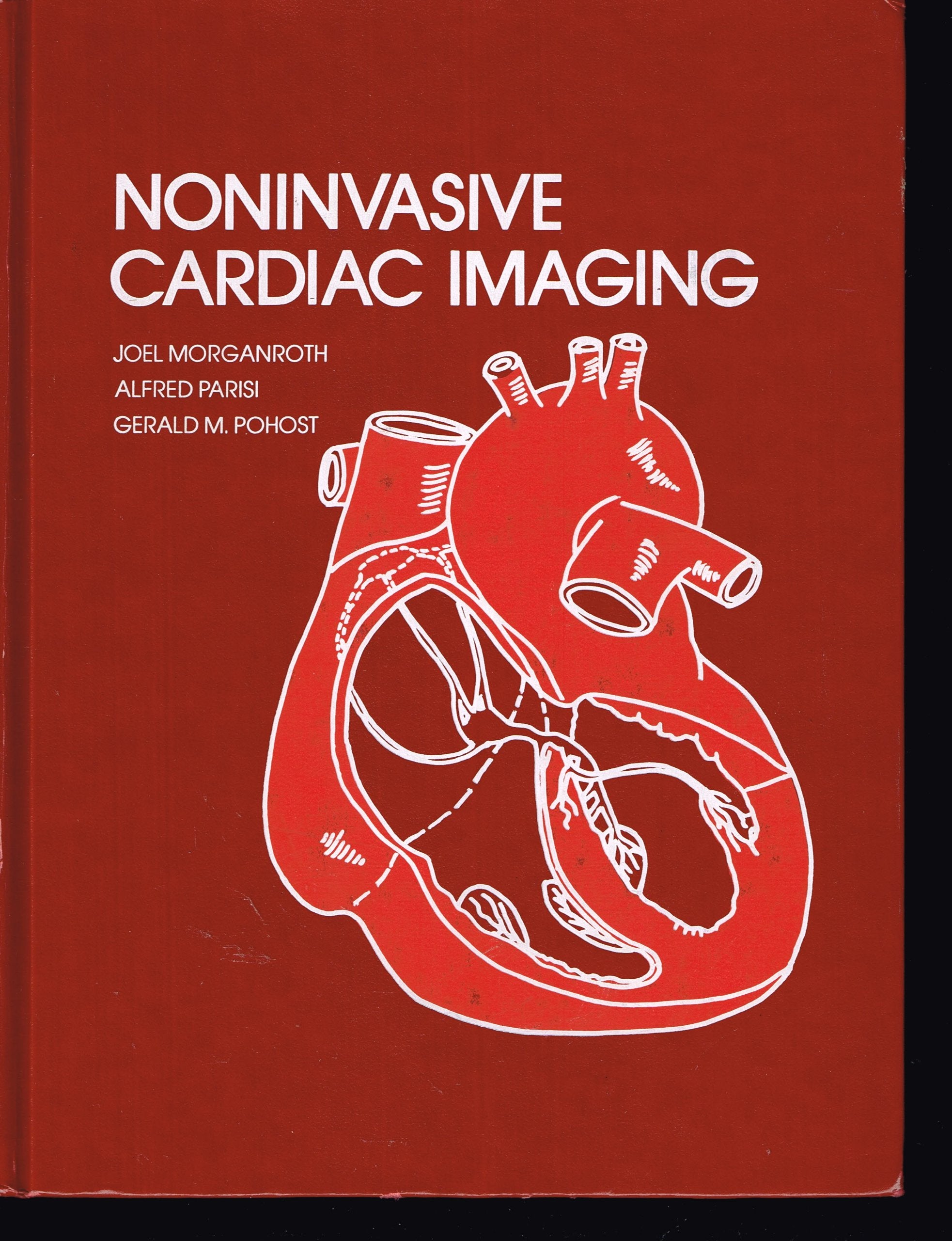 Noninvasive cardiac imaging,Used