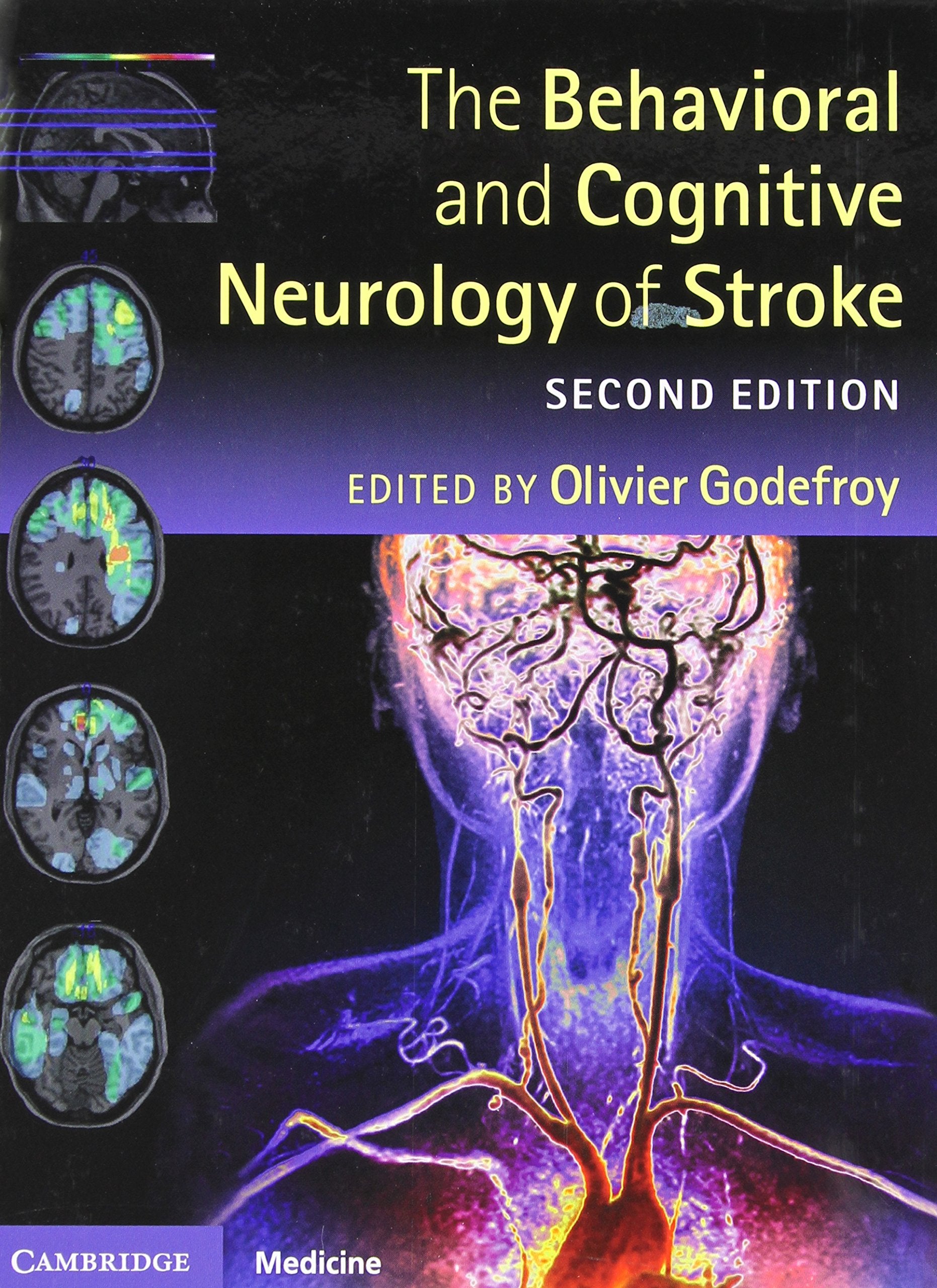 The Behavioral and Cognitive Neurology of Stroke,Used