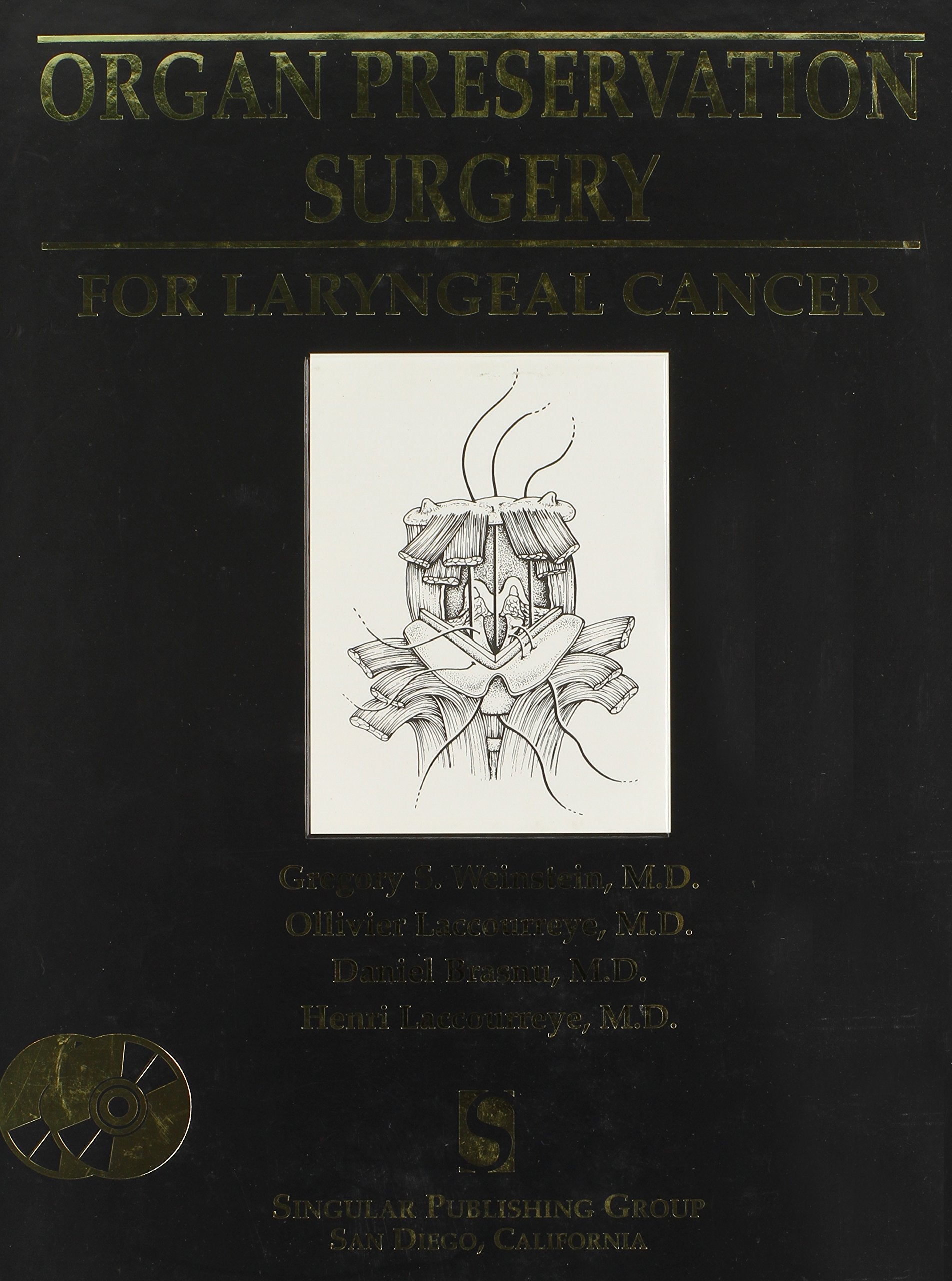 Organ Preservation Surgery For Laryngeal Cancer,Used