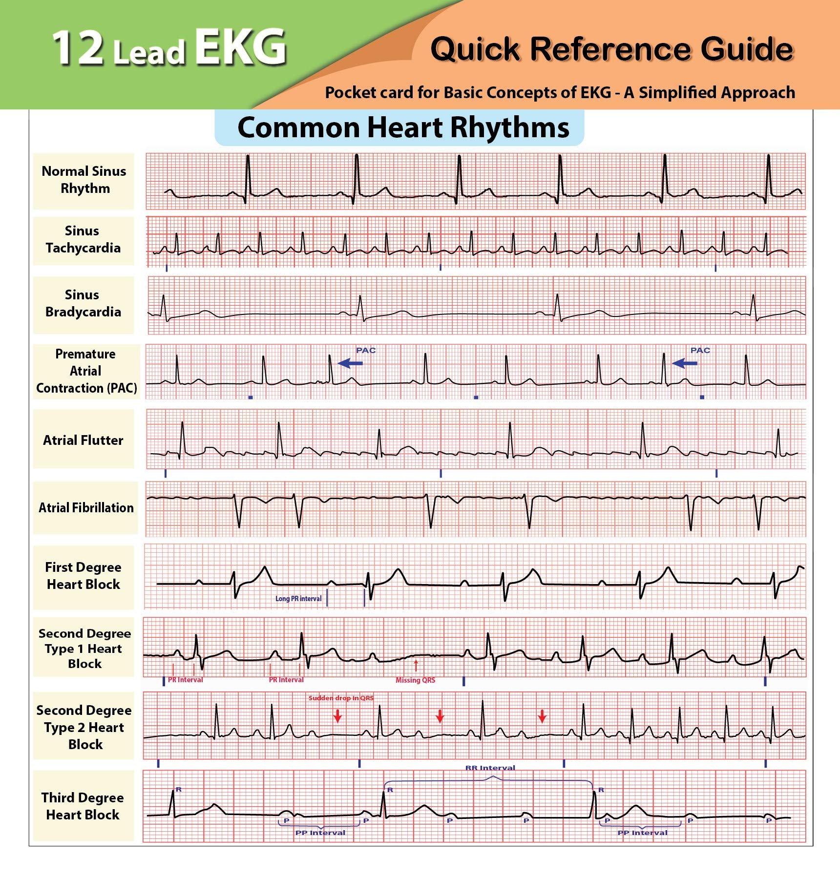 12 Lead EKG Pocket Card,Used