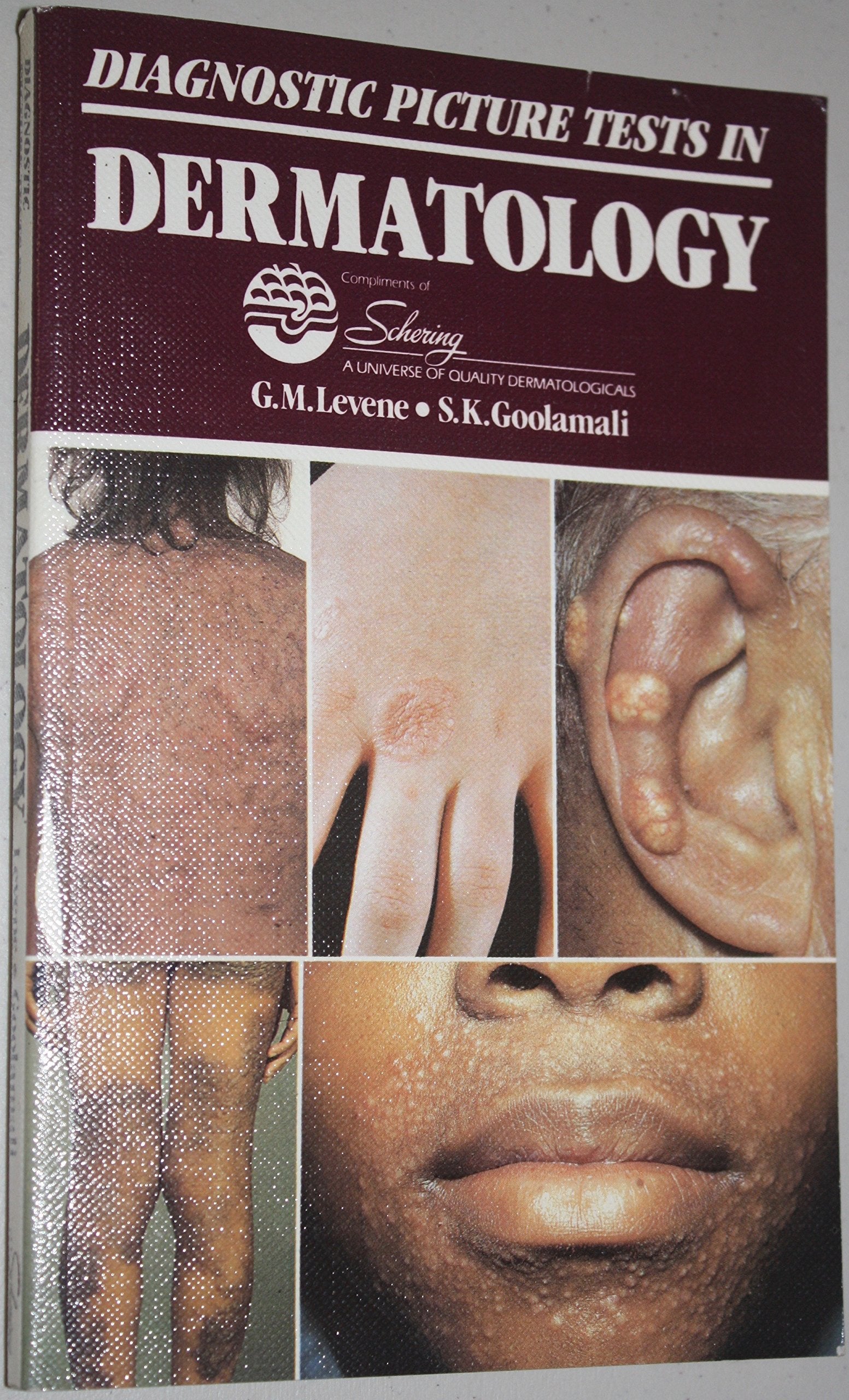 Diagnostic Picture Tests In Dermatology,Used