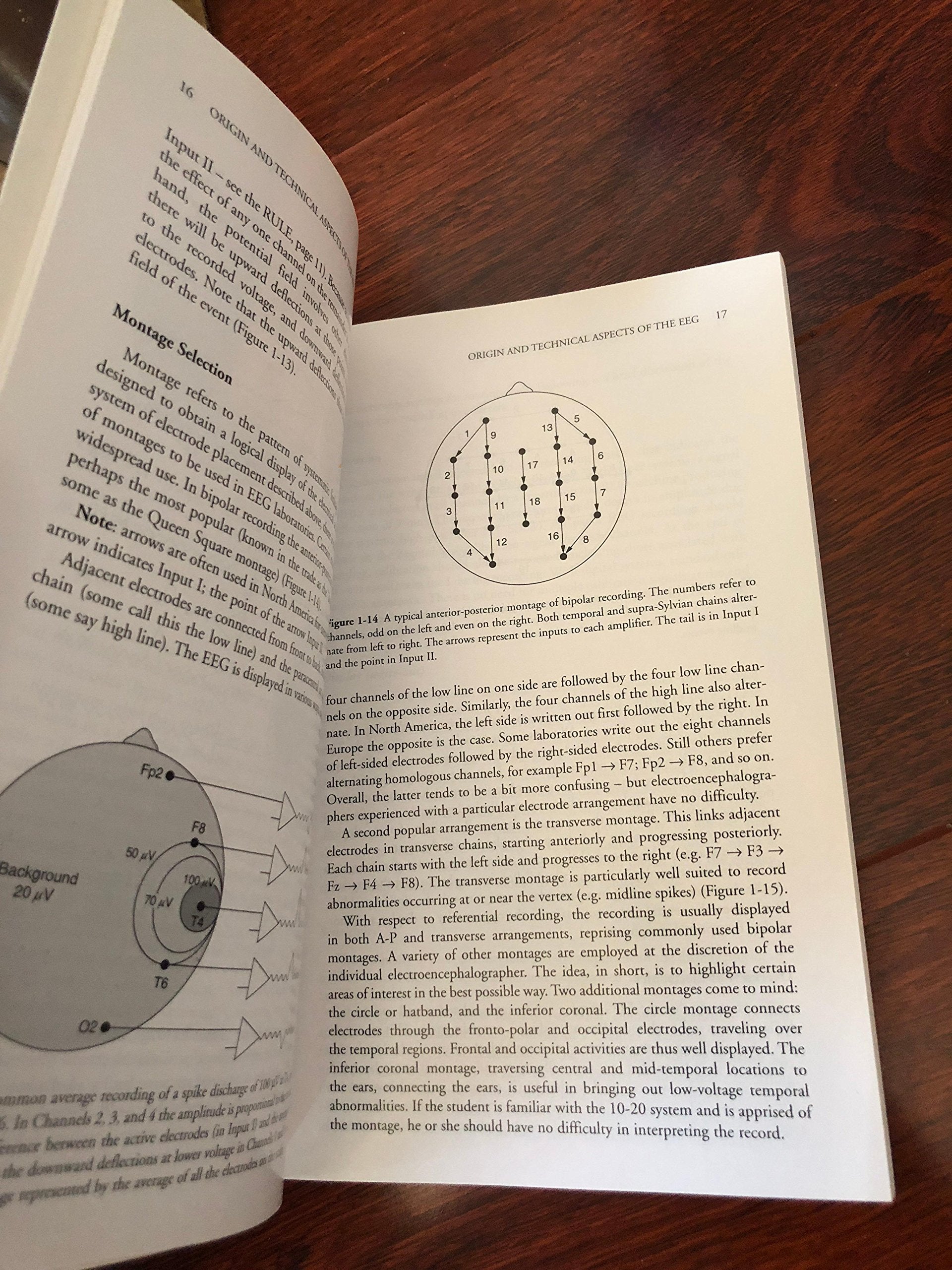 Primer of EEG: With A MiniAtlas,New