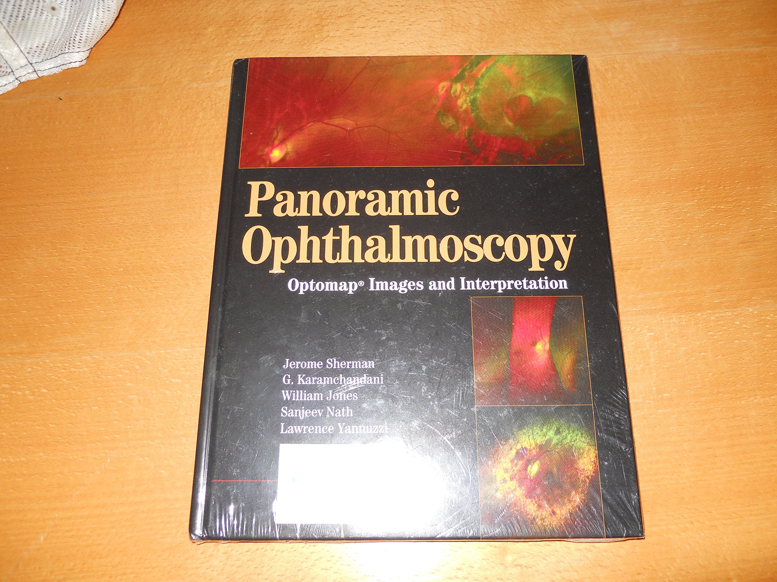 Panoramic Ophthalmoscopy: Optomap Images and Interpretation,Used
