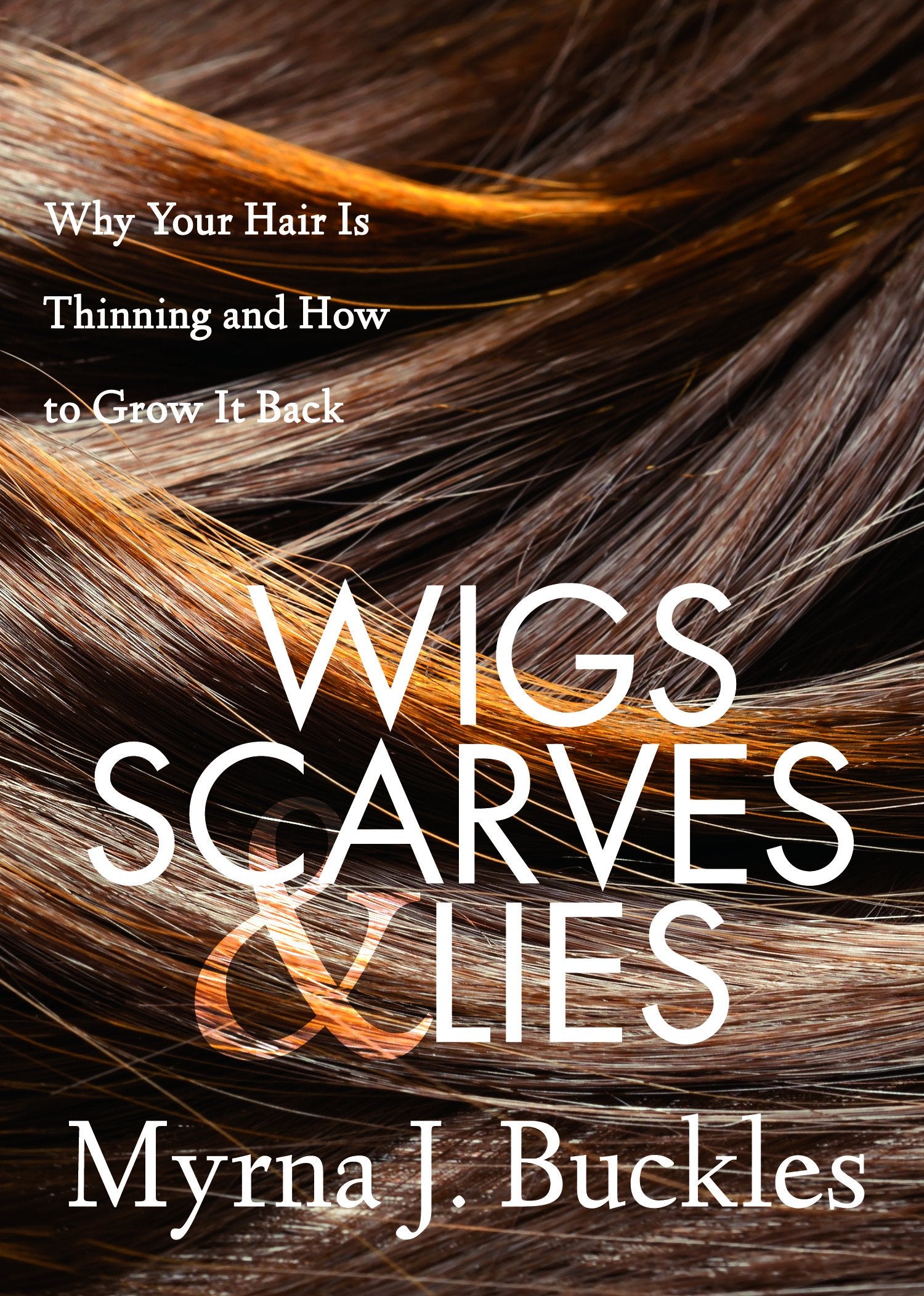 Wigs, Scarves & Lies: Why Your Hair Is Thinning and How to Grow It Back,Used
