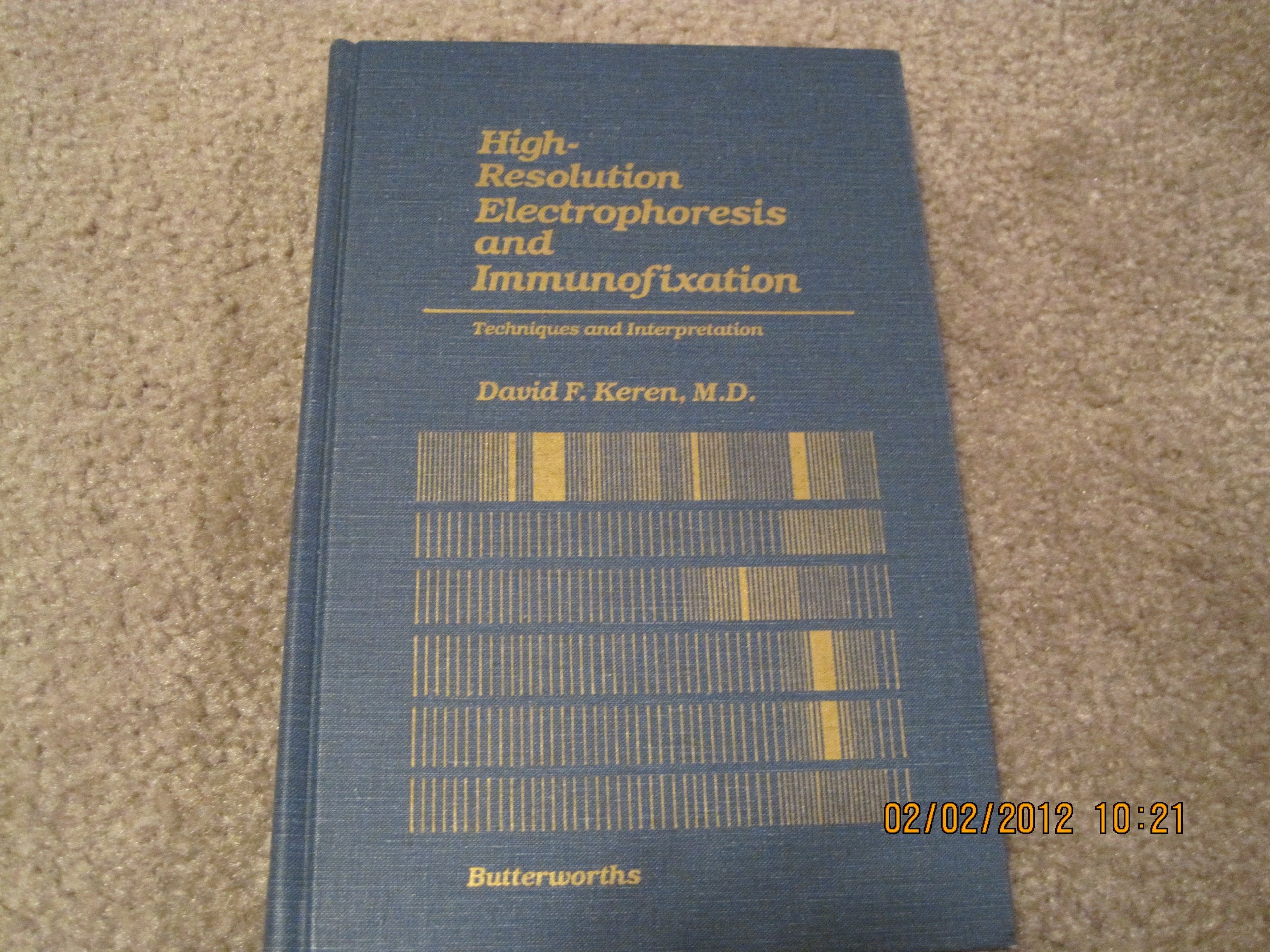 High Resolution Electrophoresis And Immunofixation: Techniques And Interpretation,Used