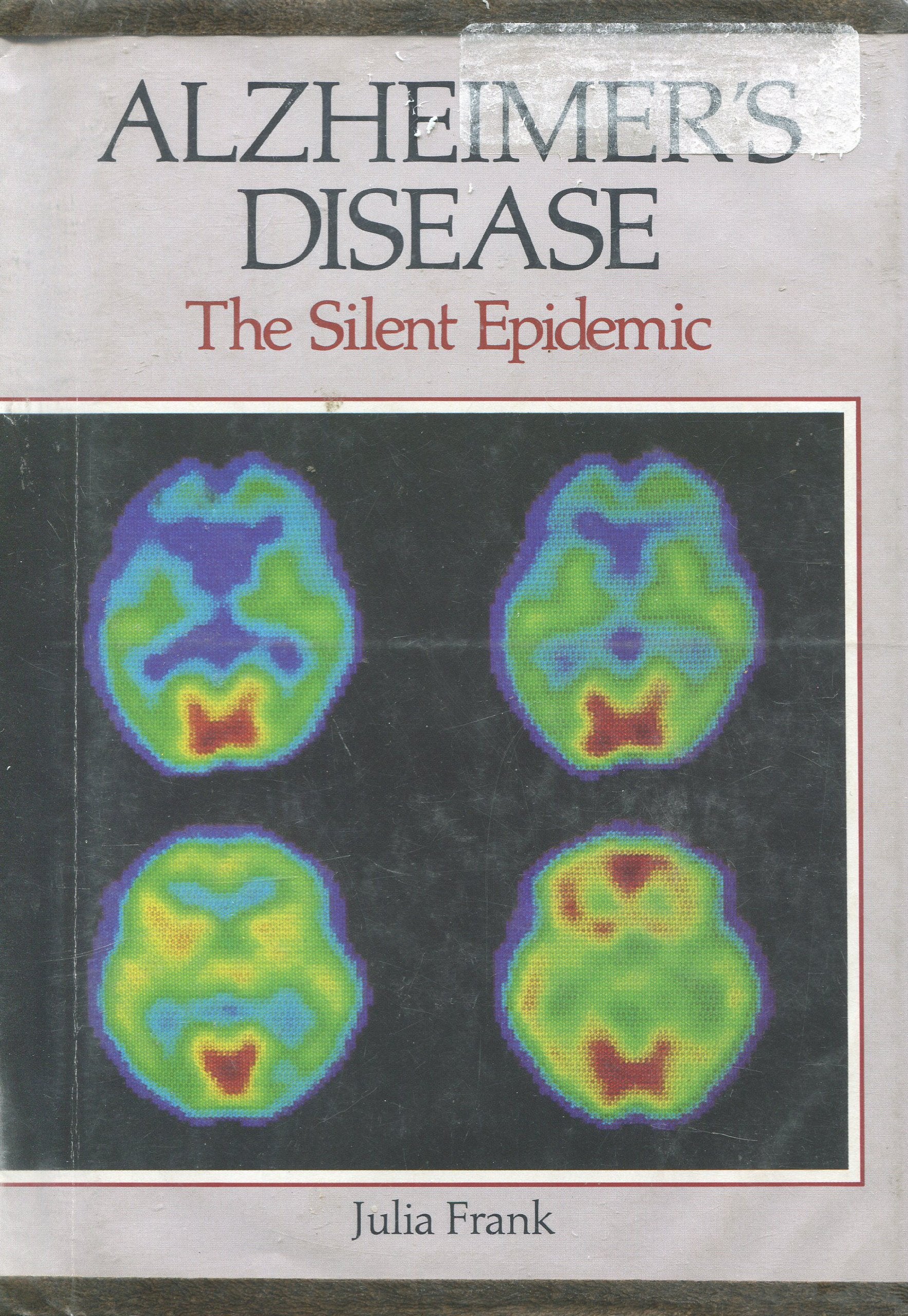 Alzheimer's Disease: The Silent Epidemic (Discovery),Used