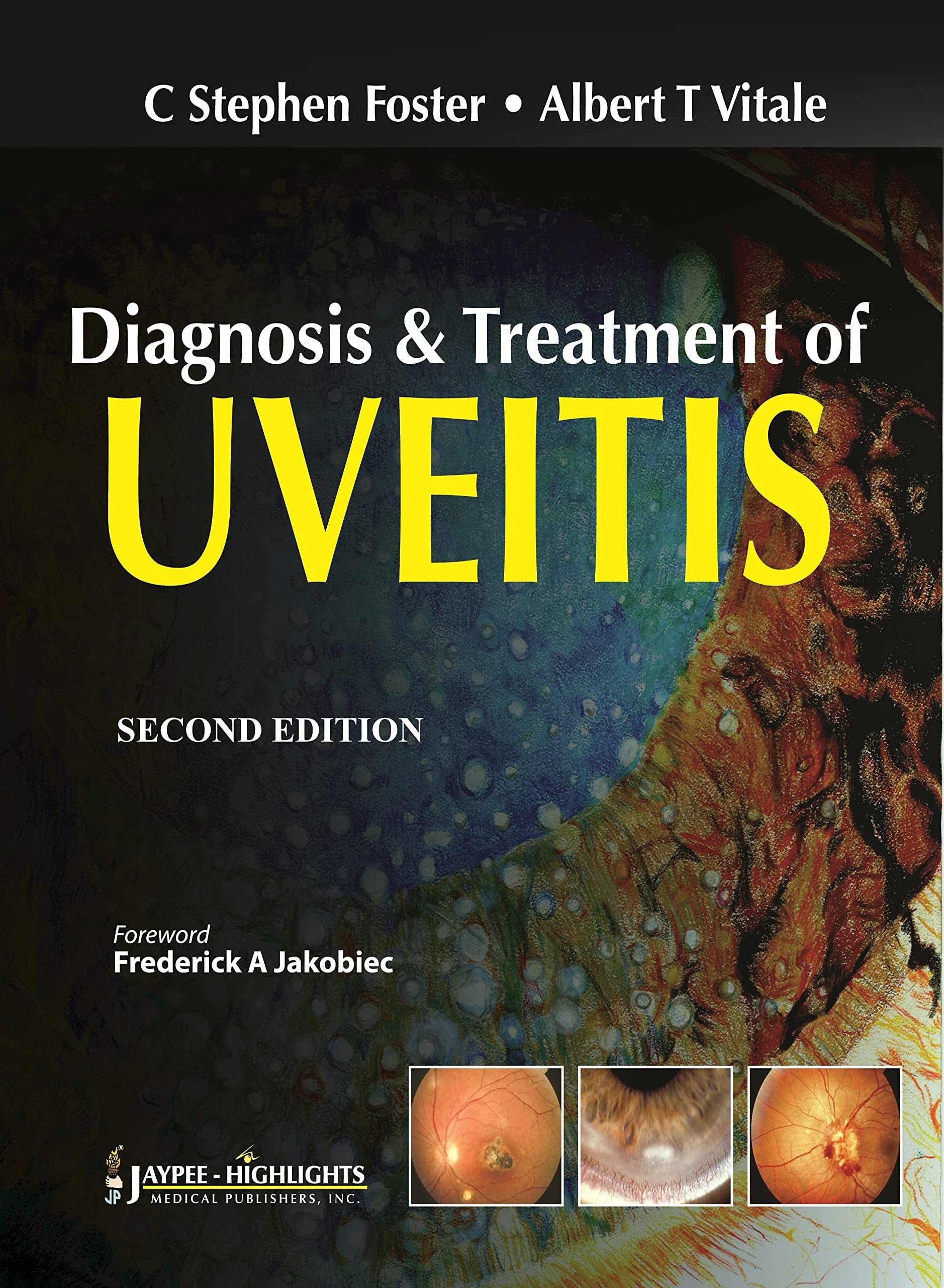 Diagnosis and Treatment of Uveitis,Used