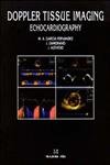 Doppler Tissue Imaging: Echocardiography,Used