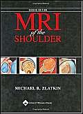 Mri of the Shoulder,Used