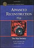 Advanced Reconstruction  Hip (Advanced Reconstruction S),Used