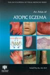 An Atlas of Atopic Eczema (Encyclopedia of Visual Medicine Series, 71),New