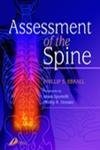 Assessment of the Spine,Used