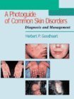 A Photoguide of Common Skin Disorders: Diagnosis and Management,Used