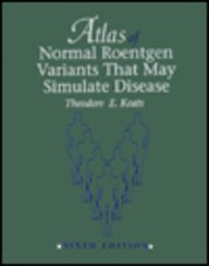 Atlas Of Normal Roentgen Variants That May Stimulate Disease,Used