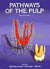 Pathways of the Pulp,Used