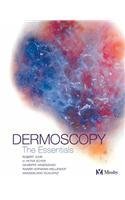 Dermoscopy,Used